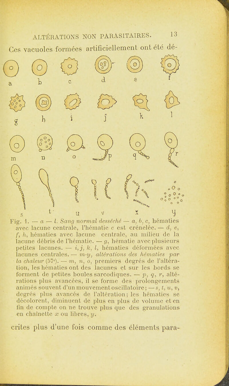 Ces vacuoles formées artificiellement ont été dé- Fig. 1. — a — l. Sang normal desséché — a, b, c, hématies avec lacune centrale, l’hématie c est crénelée. — d, e, f, h, hématies avec lacune centrale, au milieu de la iacune débris de l’hématie. — g, hématie avec plusieurs petites lacunes. — i,j, k, l, hématies déformées avec lacunes centrales. — m-y, altérations des hématies par la chaleur (57°). — m, n, o, premiers degrés de l’altéra¬ tion, les hématies ont des lacunes et sur les bords se forment de petites boules sarcodiques. — p, q, r, alté¬ rations plus avancées, il se forme des prolongements animés souvent d’un mouvement oscillatoire; —s, t, u, v, degrés plus avancés de l’altération; les hématies se décolorent, diminuent de plus en plus de volume et en fin de compte on ne trouve plus que des granulations en chaînette x ou libres, y. crites plus d’une fois comme des éléments para-
