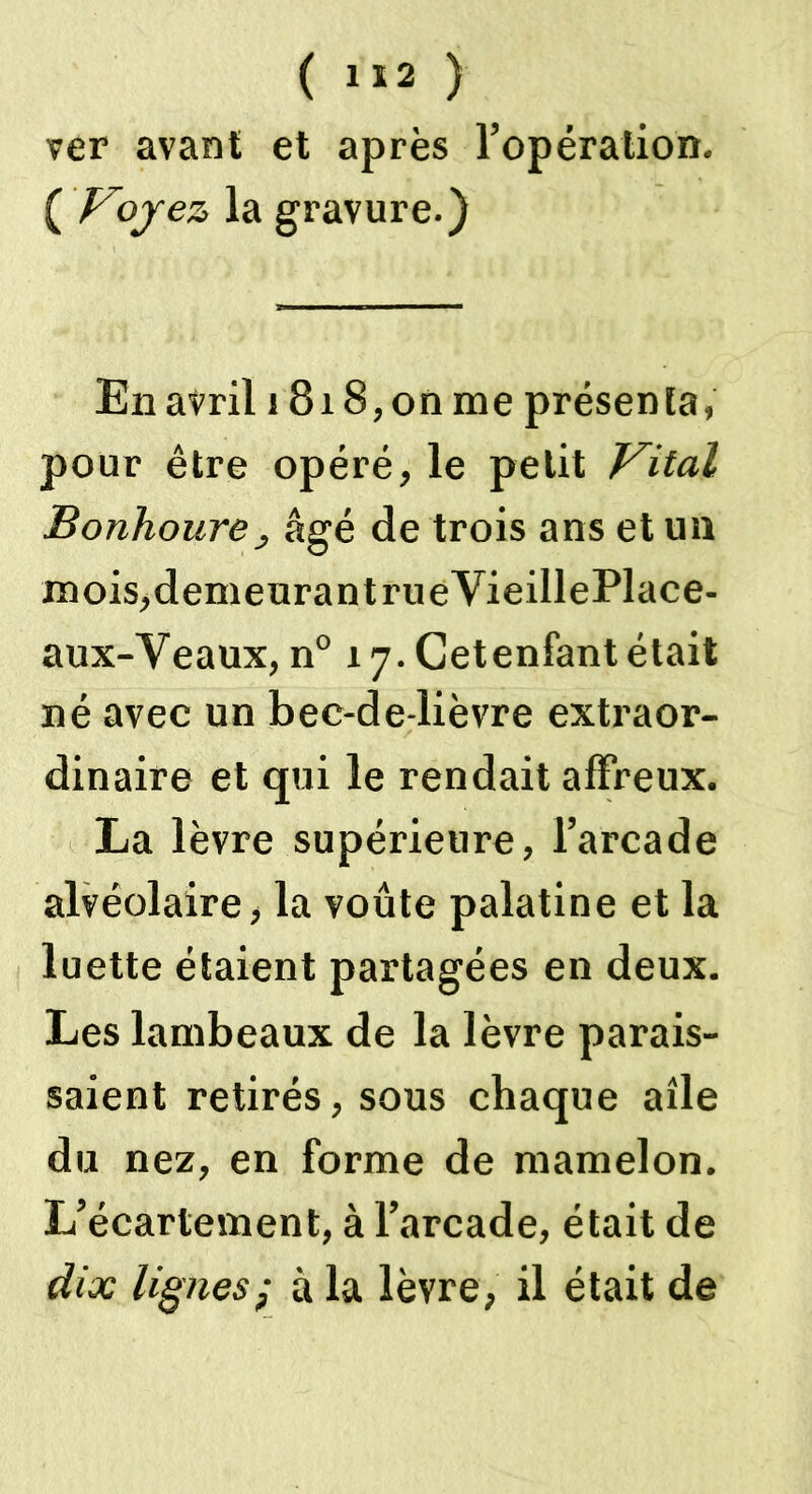 ver avant et après l’opération. ( Voyez la gravure.) En avril 1818, on me présenta, pour être opéré, le petit Vital Bonhoure j âgé de trois ans et un mois,demeurant rueVieillePlace- aux-Veaux, n° 17. Cetenfant était né avec un bec-de-lièvre extraor- dinaire et qui le rendait affreux. La lèvre supérieure, l’arcade alvéolaire, la voûte palatine et la luette étaient partagées en deux. Les lambeaux de la lèvre parais- saient retirés, sous chaque aile du nez, en forme de mamelon. L’écartement, à l’arcade, était de dix lignes; à la lèvre, il était de