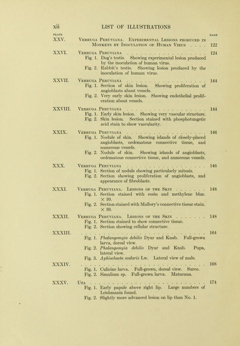 PLATE PAGE XXV. Verruga Peruviana. Experimental Lesions produced in Monkeys by Inoculation of Human Virus .... 122 XXVI. Verruga Peruviana 124 Fig. 1. Dog's testis. Showing experimental lesion produced by the inoculation of human virus. Fig. 2. Rabbit's testis. Showing lesion produced by the inoculation of human virus. XXVII. Verruga Peruviana 144 Fig. 1. Section of skin lesion. Showing proliferation of angioblasts about vessels. Fig. 2. Very early skin lesion. Sho\\ang endothelial prohf- eration about vessels. XXVIII. Verruga Peruviana 144 Fig. 1. Early skin lesion. Showing very vascular structure. Fig. 2. Skin lesion. Section stained with phosphotungstic acid stain to show vascularity. XXIX. Verruga Peruviana 146 Fig. 1. Nodule of skin. Showing islands of closely-placed angioblasts, oedematous connective tissue, and numerous vessels. Fig. 2. Nodule of skin. Showing islands of angioblasts, oedematous connective tissue, and numerous vessels. XXX. Verruga Peruviana 146 Fig. 1. Section of nodule showing particularly mitosis. Fig. 2. Section showing proliferation of angioblasts, and appearance of fibroblasts. XXXI. Verruga Peruviana. Lesions of the Skin 148 Fig. 1. Section stained with eosin and methylene blue. X 10. Fig. 2. Section stained with Mallory's connective tissue stain. X 10. XXXII. Verruga Peruviana. Lesions of the Skin 148 Fig. 1. Section stained to show connective tissue. Fig. 2. Section showing cellular structure. XXXIII 164 Fig. 1. Phalangomyia debilis Dyar and Knab. Full-grown larva, dorsal view. Fig. 2. Phalangomyia debilis Dyar and Knab. Pupa, lateral view. Fig. 3. Aphiochaeta scalaris Lw. Lateral view of male. XXXIV 168 Fig. 1. Culicine larva. Full-grown, dorsal view. Surco. Fig. 2. Simulium sp. Full-grown larva. Matucana. XXXV. Uta 174 Fig. 1. Early papule above right lip. Large numbers of Leishmania found. Fig. 2. Slightly more advanced lesion on lip than No. 1.