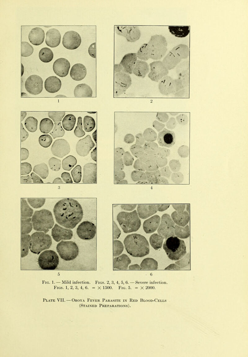 Plate VII. — Oroya Fevkr Parasite in Red Blood-Cells (Stained Preparations).