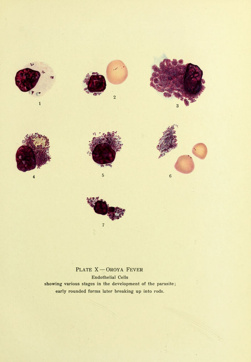 Plate X —Oroya Fever Endothelial Cells showing various stages in the development of the parasite; early rounded forms later breaking up into rods.