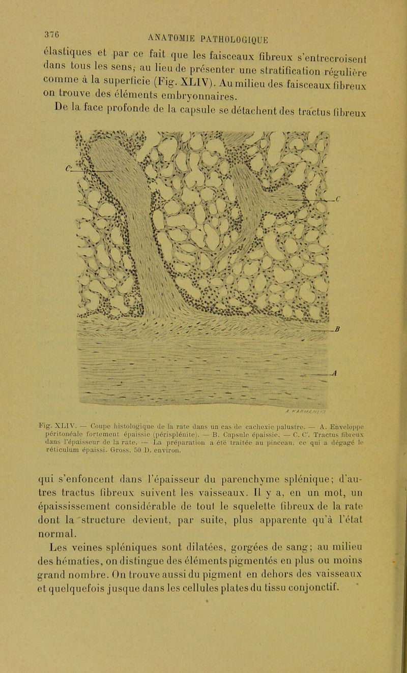 «Mastiques et par ce fait que les faisceaux fibreux s'entrecroisent dans tous les sens, au lieu de présenter une stratification régulière comme à la superficie (Kg. XL1V). Au milieu des faisceaux fibreux on trouve des éléments embryonnaires. De la face profonde de la capsule se détachent des tractus fibreux l''ig. XLIV. — Coupe histologique de fa rate dans un cas tic cachexie palustre. — A. Enveloppe pôritonéalc fortem épaissie (périsplénite). — B. Capsule épaissie. — ce. Tractus fibreux dans l'épaisseur de la rate. — La préparai ion a été t raitée au pinceau, ce qui a déparé lo réticulum épaissi. Gross. 50 1). environ. qui s'enfoncent dans l'épaisseur du parenchyme splénique; d'au- tres tractus fibreux suivent les vaisseaux. Il v a, en un mot, un épaississement considérable de tout le squelette fibreux de la rate dont la structure devient, par suite, plus apparente qu'à l'état normal. Les veines spléniques sont dilatées, gorgées de sang; au milieu des hématies, on distingue des éléments pigmentés en plus ou moins grand nombre. On trouve aussi du pigment en dehors des vaisseaux et quelquefois jusque dans les cellules [da tes du tissu conjonctif.