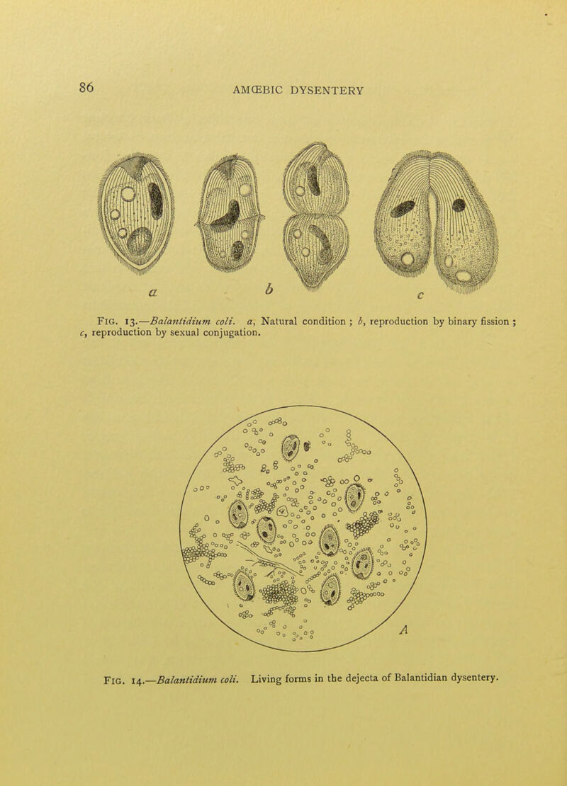 Fig. \a,.—Balanlidium colt. Living forms in the dejecta of Balantidian dysentery.
