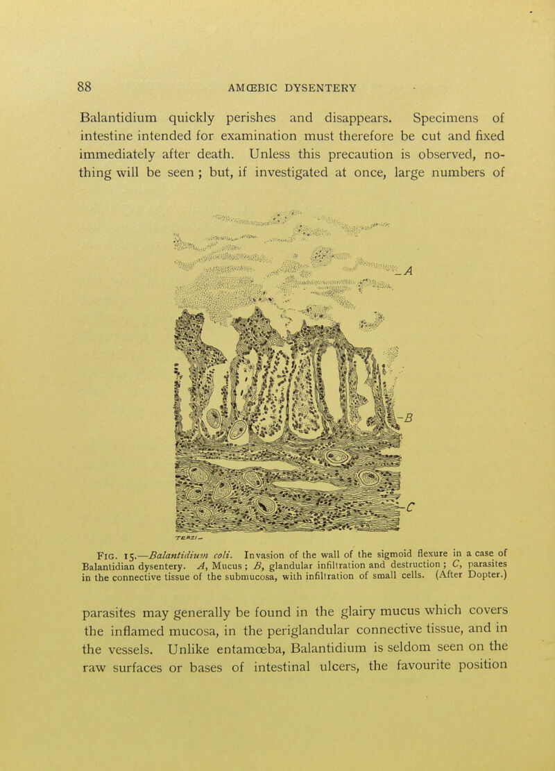 Balantidium quickly perishes and disappears. Specimens of intestine intended for examination must therefore be cut and fixed immediately after death. Unless this precaution is observed, no- thing will be seen ; but, if investigated at once, large numbers of Fig. 15.—Balantidium coli. Invasion of the wall of the sigmoid flexure in a case of Balantidian dysentery. A, Mucus ; B, glandular infiltration and destruction ; C, parasites in the connective tissue of the submucosa, with infiltration of small cells. (After Dopter.) parasites may generally be found in the glairy mucus which covers the inflamed mucosa, in the periglandular connective tissue, and in the vessels. Unlike entamoeba, Balantidium is seldom seen on the raw surfaces or bases of intestinal ulcers, the favourite position