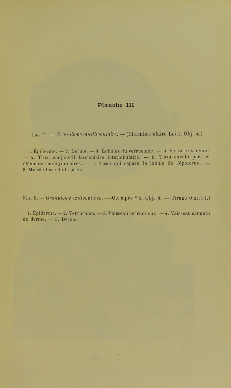 Fig. 7. — Granulome multilobulaire.— (Chambre claire Leitz. Obj. 4.) 1. Épidémie. — 2. Derme. — 3. Lobules rlu verrucome. — 4. Vaisseau sanguin. — 5. Tissu conjonctif fasciculaire interlobulaire. — C. Tissu envahi par les éléments embryonnaires. — 7. Tissu qui sépare le lobule de l'épiderme. — 8. Muscle lisse de la peau. Fig. 8.— Granulome unilobulaire. — (Oc. àprojn4. Obj. 8. — Tirage Om.31.) 1. Épiderme. — 2. Verrucome. — 3. Vaisseau verruqueux. — 4. Vaisseau sanguin du derme. — 5. Derme.