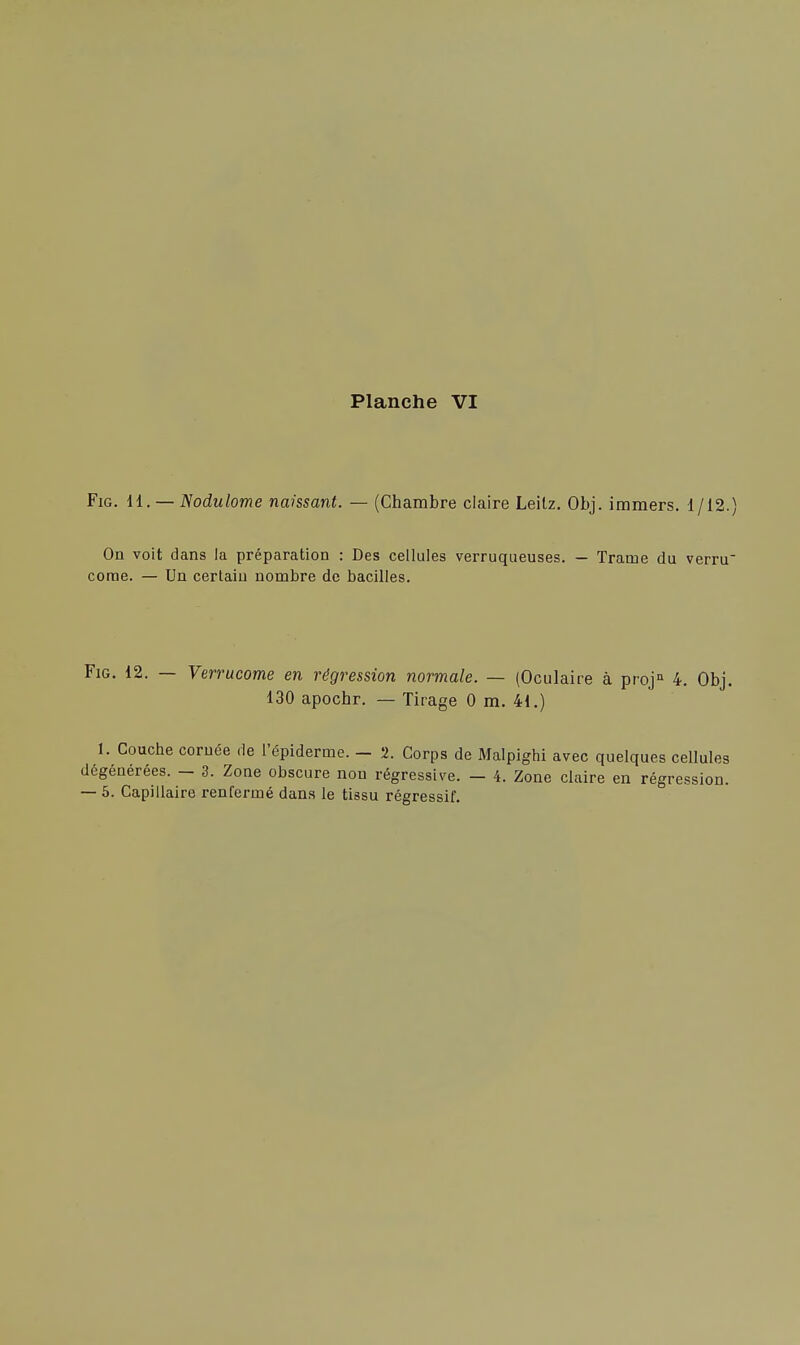 Fig. 11. — Nodulome naissant. — (Chambre claire Leitz. Obj. immers. 1/12.) On voit dans la préparation : Des cellules verruqueuses. — Trame du verru corne. — Un certain nombre de bacilles. Fig. 12. — Verrucome en régression normale. — (Oculaire à projn 4. Obj. 130 apochr. — Tirage 0 m. 41.) 1. Couche cornée de l'épiderme. - 2. Corps de Malpighi avec quelques cellules dégénérées. - 3. Zone obscure non régressive. - 4. Zone claire en régression. — 5. Capillaire renfermé dans le tissu régressif.