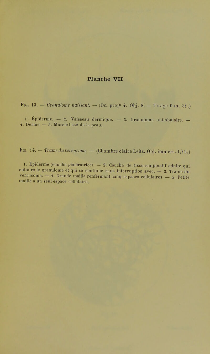 Fig. 13. — Granulome naissant. — (Oc. projn 4. Obj. 8. — Tirage 0 m. 31.) I. Épidémie. — 2. Vaisseau dermique. — 3. Granulome uuilobulaire. — 4. Derme — 5. Muscle lisse de la peau. Fig. 14. — Trame du verrucome. — (Chambre claire Leitz. Obj. immers. 1/12.) 1. Épiderme (couche génératrice). — 2. Couche de tissu conjonctif adulte qui entoure le granulome et qui se continue sans interruption avec. — 3. Trame du verrucome. — 4. Grande maille renfermant cinq espaces cellulaires. — 5. Petite maille à un seul espace cellulaire.