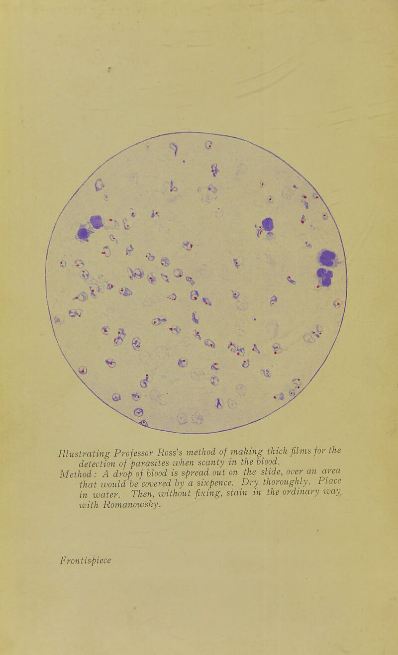Illustrating Professor Ross's method of making thick films for the detection of parasites when scanty in the blood. Method: A drop of blood is spread out on the slide, over an area that -would be covered by a sixpence. Dry thoroughly. Place in water. Then, without fixing, stain in the ordinary way with Romanowsky. Frontispiece