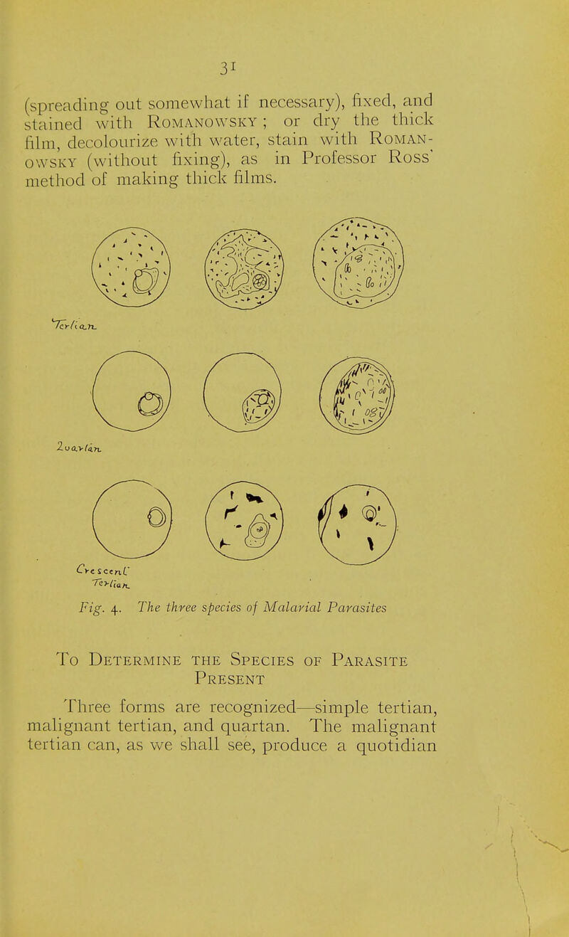 (spreading out somewhat if necessary), fixed, and stained with Romanowsky ; or dry the thick film, decolourize with water, stain with Roman- owsky (without fixing), as in Professor Ross' method of making thick films. Fig. 4. The three species of Malarial Parasites To Determine the Species of Parasite Present Three forms are recognized—simple tertian, malignant tertian, and quartan. The malignant tertian can, as we shall see, produce a quotidian