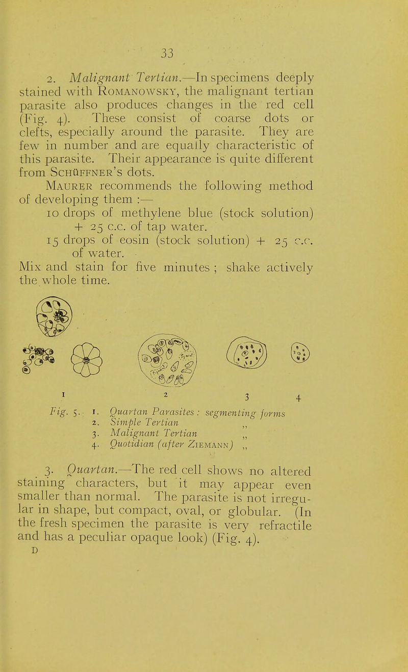 2. Malignant'Tertian.—In specimens deeply stained with Romanowsky, the malignant tertian parasite also produces changes in the red cell (Fig. 4). These consist of coarse dots or clefts, especially around the parasite. They are few in number and are equatly characteristic of this parasite. Their appearance is quite different from SchUffner's dots. Maurer recommends the following method of developing them :— 10 drops of methylene blue (stock solution) + 25 c.c. of tap water. 15 drops of eosin (stock solution) + 25 c.c. of water. • Mix and stain for five minutes ; shake actively the whole time. Fig- $•; *• Quartan Parasites : segmenting forms 2. Simple Tertian 3. Malignant Tertian 4. Quotidian (after ZiemannJ 3. Quartan.—The red cell shows no altered staining characters, but it may appear even smaller than normal. The parasite is not irregu- lar in shape, but compact, oval, or globular. (In the fresh specimen the parasite is very refractile and has a peculiar opaque look) (Fig. 4). D