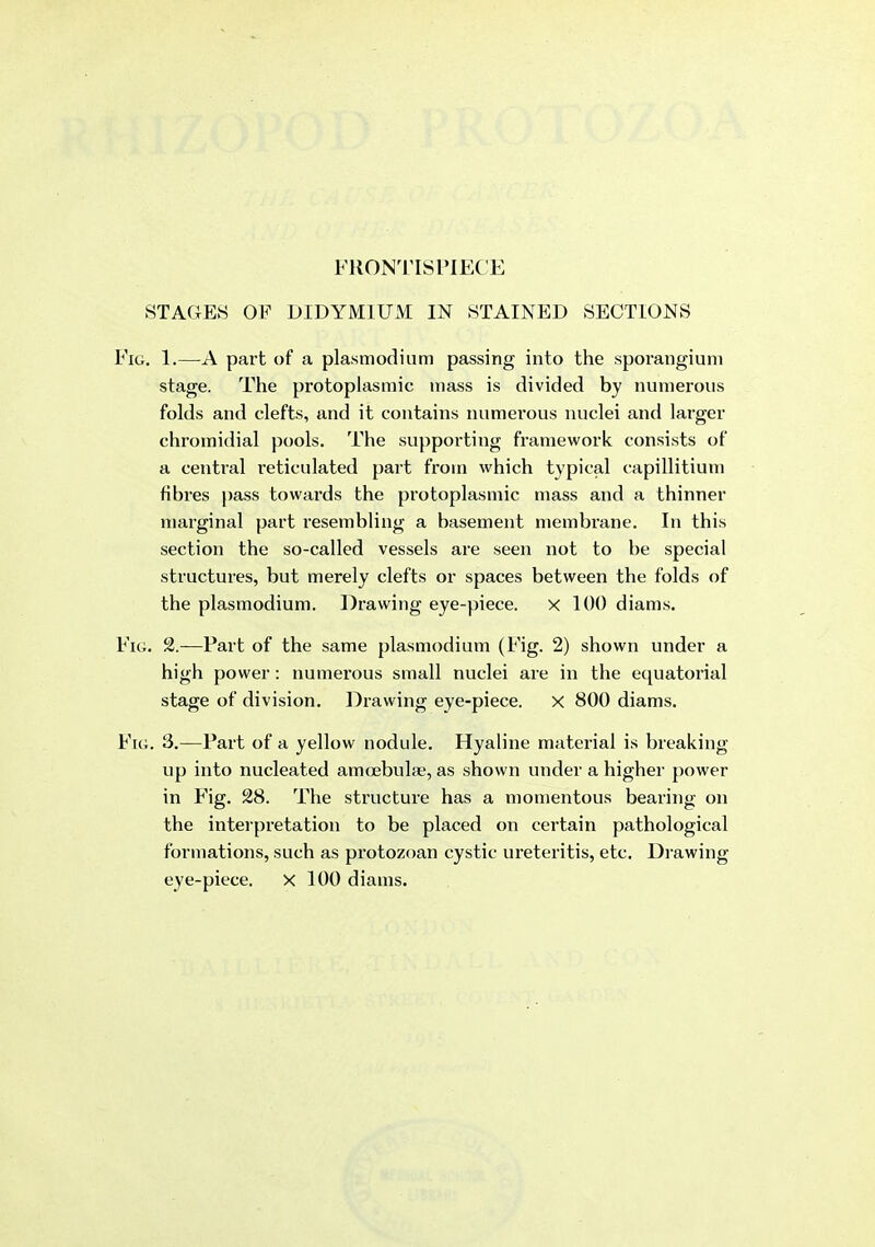 FUONTISPIECE STAGES OF DIDYMlUxM IN STAINED SECTIONS Fig. 1.—part of a plasmodium passing into the sporangium stage. The protoplasmic mass is divided by numerous folds and clefts, and it contains numei'ous nuclei and larger chromidial pools. The supporting framework consists of a central reticulated part from which typical capillitium fibres pass towards the protoplasmic mass and a thinner marginal part resembling a basement membrane. In this section the so-called vessels are seen not to be special structures, but merely clefts or spaces between the folds of the Plasmodium. Drawing eye-piece. x 100 diams. Fig. 2.—Part of the same plasmodium (Fig. 2) shown under a high power: numerous small nuclei are in the equatorial stage of division. Drawing eye-piece. X 800 diams. Fig. 3.—Part of a yellow nodule. Hyaline material is breaking up into nucleated amoebulae, as shown under a higher power in Fig. 28. The structure has a momentous bearing on the interpretation to be placed on certain pathological formations, such as protozoan cystic ureteritis, etc. Drawing eye-piece. x 100 diams.