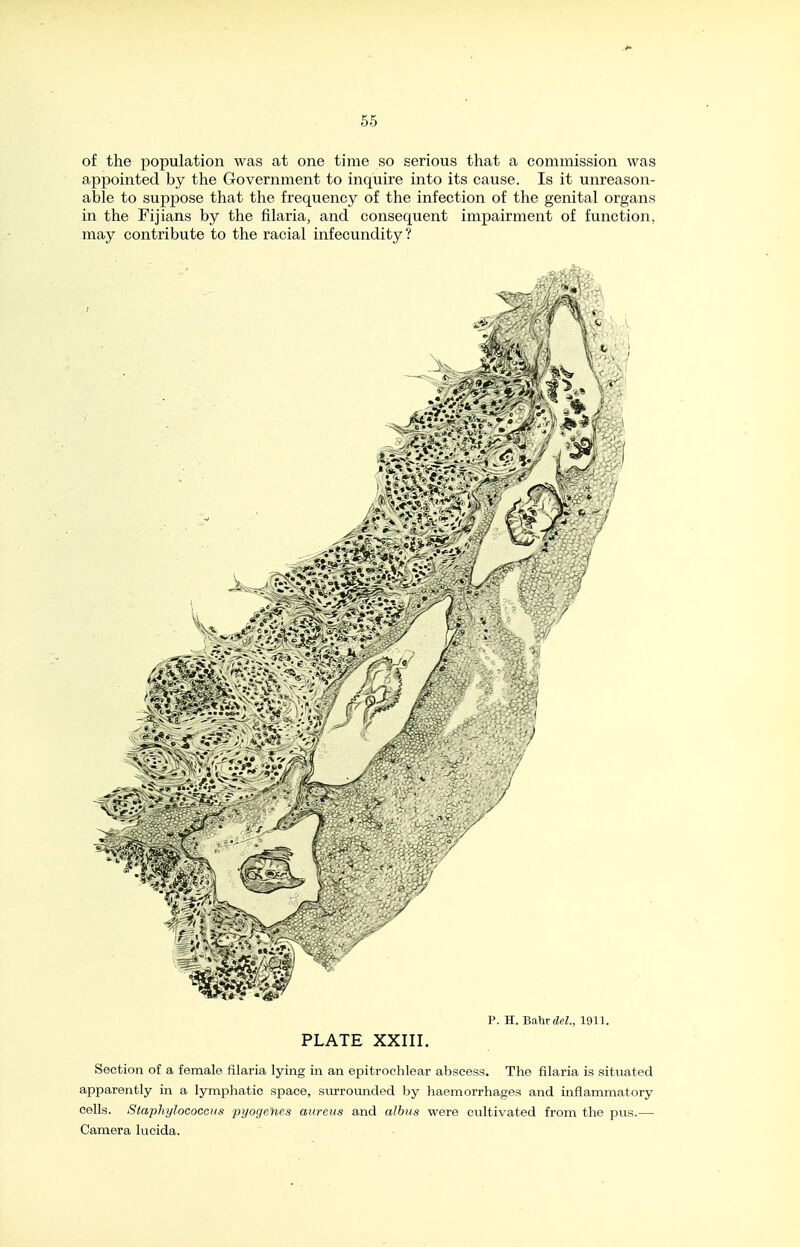 of the population was at one time so serious that a commission was appointed by the Government to inquire into its cause. Is it unreason- able to suppose that the frequency of the infection of the genital organs in the Fijians by the filaria, and consequent impairment of function, may contribute to the racial infecundity ? 'Of p. H. Bahrde?., 1911. PLATE XXIII. Section of a female filaria lying in an epitrochlear abscess. The filaria is situated apparently in a lymphatic space, surrounded by haemorrhages and inflammatory cells. Staphylococcus pyogenes aureus and alhus were cultivated from the pus.— Camera lucida.