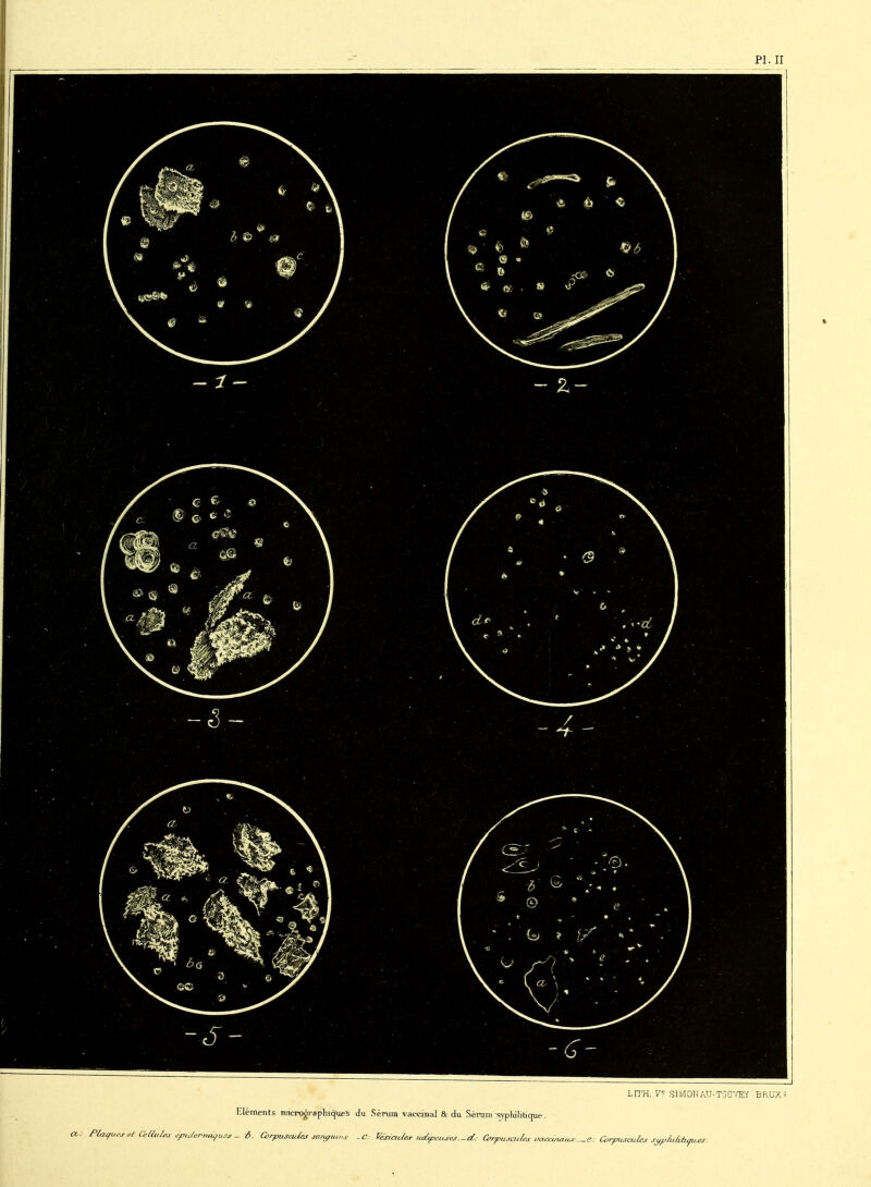 LITH. V* SlWOUAU-TOO'/Eï BKUX? éléments micrp^rapliicjUeS du Sérum vaccjnal & du Sèrani sypWlihope.