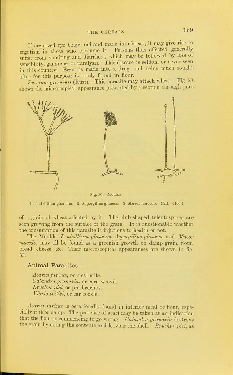 If ei-o'otized rye be .ground and made into bread, it may give rise to er^otisin in those who consume it. Persons thus affected generally suffer from vomiting and diarrhoea, which may be followed by loss of sensibility, gangrene, or paralysis. This disease is seldom or never seen in this country. Ergot is made into a drug, and being much sought after for this purpose is rarely found in flour. Puccinia graminis (Rust).—This parasite may attack wheat. Fig. 2S shows the microscopical appearance presented by a section tlirough ]iart. Fig. 30.—Moulds 1, Penicilliuii) glaucuiii. 2, Asiiergillus glaucus. 3, Mucor mucedo. (All, x 100.) of a grain of wheat affected by it. The club-shaped teleutospores are' seen growing from the surface of the grain. It is questionable whether the consumption of tliis parasite is injurious to health or not. The Moulds, Penicillmm glaucum, Aspergillus glaucus, and Mucc/r mucedo, may all be found as a greenish growth on damp grain, flour, bread, cheese, &c. Their microscopical appearances are shown in fig. 30. Animal Parasites— Acarus farincB, or meal mite. Calandra granaria. or corn weevil. Bruchus pisi, or pea bruchus. Vibrio tritici, or ear cockle. Acarus farince is occasionally found in inferioi- meal or flour, espe- cially if it be (lamp. The presence of acari may be taken as an indication that the flour is commencing to go wrong. Calandra granaria destroys the gi-ain by eating the contents and leaving the shell. Bruchus pisi, as-