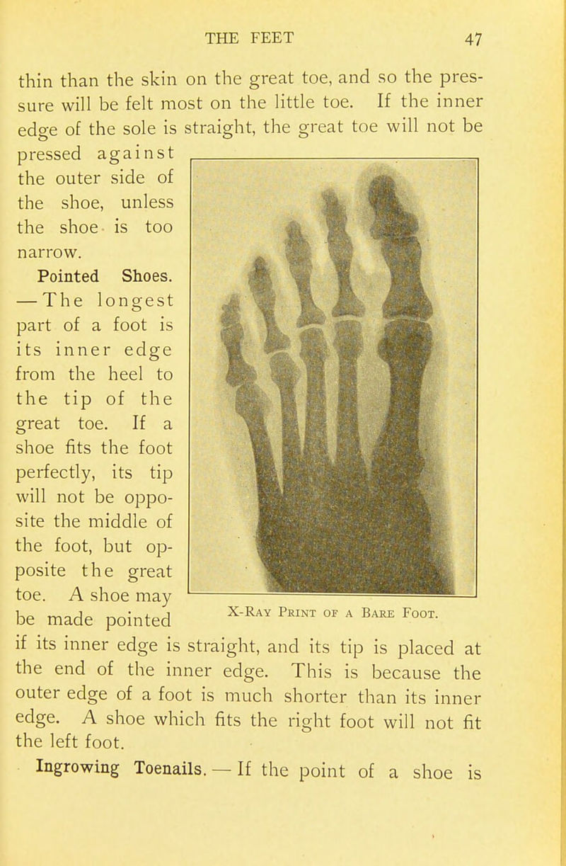 thin than the skin on the great toe, and so the pres- sure will be felt most on the little toe. If the inner edge of the sole is straight, the great toe will not be pressed against the outer side of the shoe, unless the shoe is too narrow. Pointed Shoes. — The longest part of a foot is its inner edge from the heel to the tip of the great toe. If a shoe fits the foot perfectly, its tip will not be oppo- site the middle of the foot, but op- posite the great toe. A shoe may be made pointed X-Ray Print of a Bare Foot. if its inner edge is straight, and its tip is placed at the end of the inner edge. This is because the outer edge of a foot is much shorter than its inner edge. A shoe which fits the right foot will not fit the left foot. Ingrowing Toenails. — If the point of a shoe is