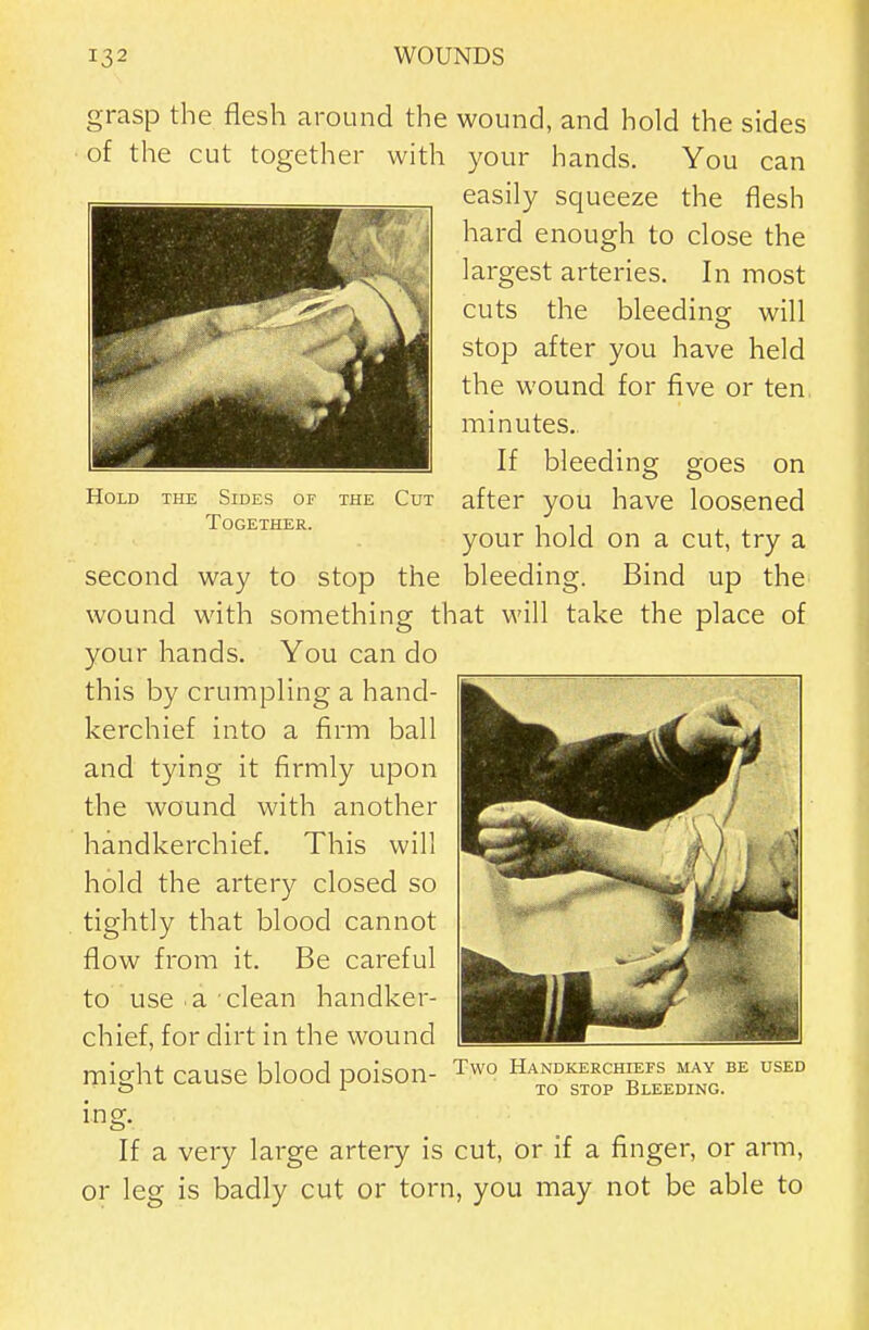 grasp the flesh around the wound, and hold the sides of the cut together with your hands. You can easil}^ squeeze the flesh hard enough to close the largest arteries. In most cuts the bleeding will stop after you have held the wound for five or ten minutes.. If bleeding goes on after you have loosened your hold on a cut, try a bleeding. Bind up the Hold THE Sides of Together. THE Cut second way to stop the wound with something that will take the place of your hands. You can do this by crumpling a hand- kerchief into a firm ball and tying it firmly upon the wound with another handkerchief. This will hold the artery closed so tightly that blood cannot flow from it. Be careful to use a clean handker- chief, for dirt in the wound mi^ht cause blood poison- Two Handkerchiefs may be used t5 JO STOP Bleeding. ing. If a very large artery is cut, or if a finger, or arm, or leg is badly cut or torn, you may not be able to