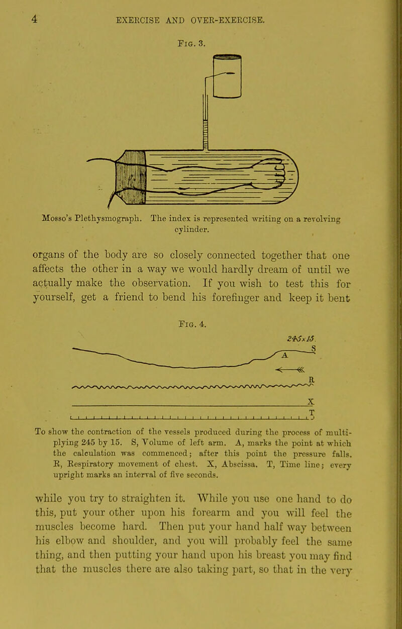 Fig. 3. MoBso's Plethysmograpli. The index is represented writing on a rerolving cylinder. organs of the body are so closely connected together that one affects the other in a way we would hardly dream of until we actually make the observation. If you wish to test this for yourself, get a friend to bend his forefinger and keep it bent Fig. 4. X T I I 1 I I J I I 1 1 1 I 1 I I I I I I 1 I I I I I 1 I I I 1 I L J To show the contraction of the vessels produced during the process of multi- plying 245 by 15. S, Volume of left arm. A, marks the point at which the calculation was commenced; after tliis point the pressure falls. R, Eespiratory movement of chest. X, Abscissa. T, Time line; every upright marks an interval of five seconds. while you try to straighten it. While you use one hand to do this, put your other upon his forearm and you will feel the muscles become hard. Then put your hand half way between his elbow and shoulder, and you will probably feel the same thing, and then putting your hand upon his breast you may find that the muscles there are also taking part, so that in the very