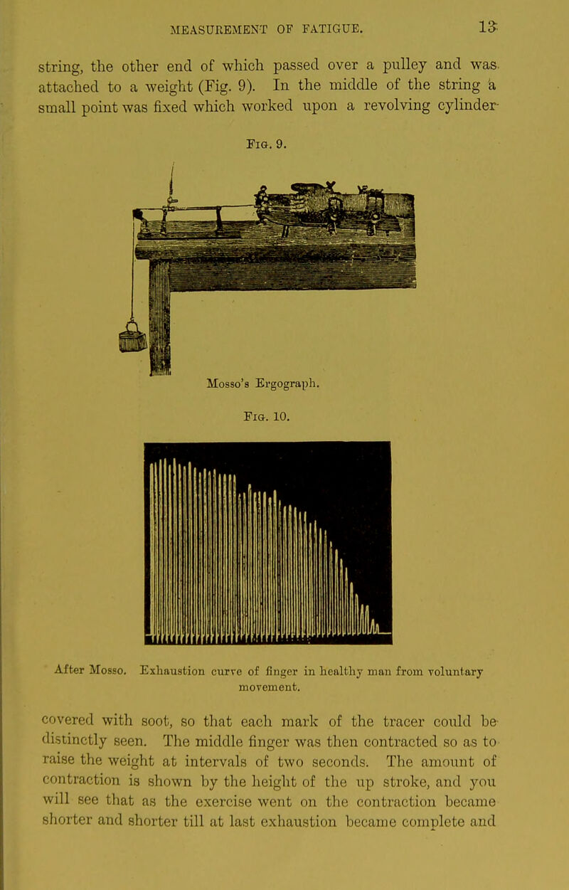 MEASUREMENT OF PATIGUE. string, the other end of which passed over a pulley and was. attached to a weight (Fig. 9). In the middle of the string 'a small point was fixed which worked upon a revolving cylinder- FiG. 9. Mosso's Ergograph. Fig. 10. After Mosso. Exhaustion curve of finger in healthy man from voluntary movement. covered with soot, so that each mark of the tracer could he distinctly seen. The middle finger was then contracted so as to raise the weight at intervals of two seconds. The amount of contraction is shown by the height of the up stroke, and you will see that as the exercise went on the contraction became shorter and shorter till at last exhaustion became complete and