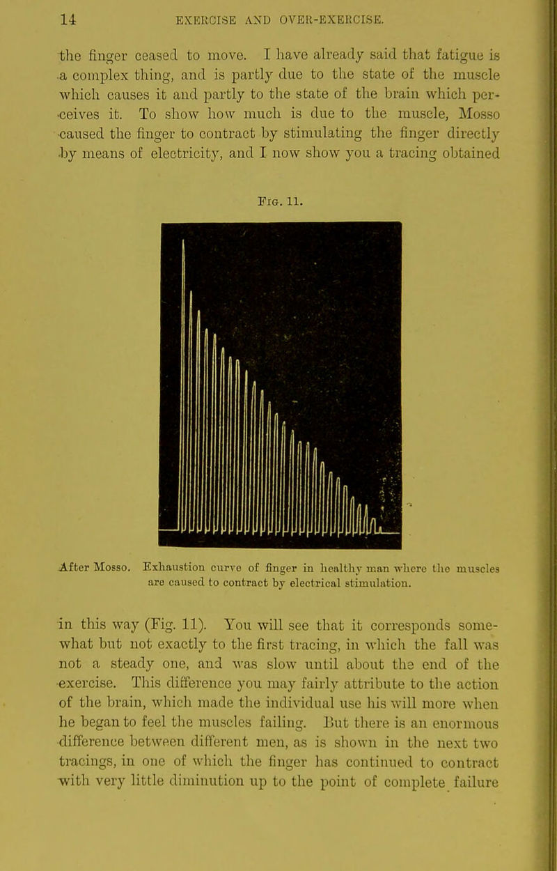 the finger ceased to move. I have ah^eady said that fatigue is a complex thing, and is partly due to the state of the muscle which causes it and partly to the state of the brain which per- •ceives it. To show how much is due to the muscle, Mosso •caused the finger to contract by stimulating the finger directly •by means of electricity, and I now show you a tracing obtained Fig. 11. After Mosso. Exhaustion curve of finger in healthy man where the muscles are caused to contract by electrical stimulation. in this way (Fig. 11). You will see that it corresponds some- what but not exactly to the first tracing, in which the fall was not a steady one, and was slow until about the end of the •exercise. This difference you may fairly attribute to the action of the brain, which made the individual use his will more when he began to feel the muscles failing. But there is an enormous ■difference between different men, as is shown in the next two tracings, in one of whicli the finger has continued to contract with very little diminution up to the point of complete failure