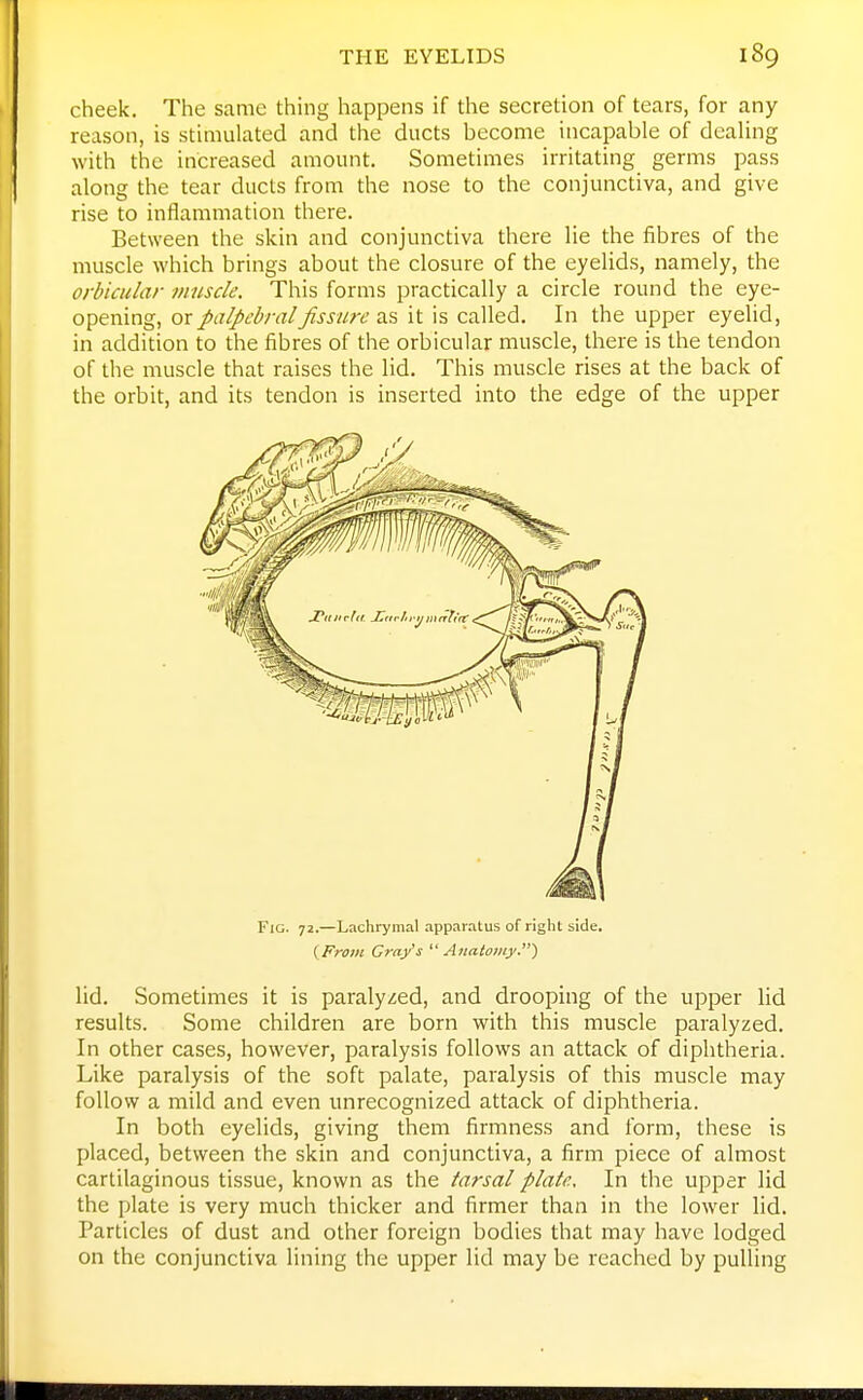 cheek. The same thing happens if the secretion of tears, for any reason, is stimulated and the ducts become incapable of dealing with the increased amount. Sometimes irritating germs pass along the tear ducts from the nose to the conjunctiva, and give rise to inflammation there. Between the skin and conjunctiva there lie the fibres of the muscle which brings about the closure of the eyelids, namely, the orbicular muscle. This forms practically a circle round the eye- opening, or palpebral fissure as it is called. In the upper eyelid, in addition to the fibres of the orbicular muscle, there is the tendon of the muscle that raises the lid. This muscle rises at the back of the orbit, and its tendon is inserted into the edge of the upper lid. Sometimes it is paralyzed, and drooping of the upper lid results. Some children are born with this muscle paralyzed. In other cases, however, paralysis follows an attack of diphtheria. Like paralysis of the soft palate, paralysis of this muscle may follow a mild and even unrecognized attack of diphtheria. In both eyelids, giving them firmness and form, these is placed, between the skin and conjunctiva, a firm piece of almost cartilaginous tissue, known as the tarsal plate. In the upper lid the plate is very much thicker and firmer than in the lower lid. Particles of dust and other foreign bodies that may have lodged on the conjunctiva lining the upper lid may be reached by pulling Fig. 72.—Lachi-ymal apparatus of right side. (From Gray's '■^Anatomy.)