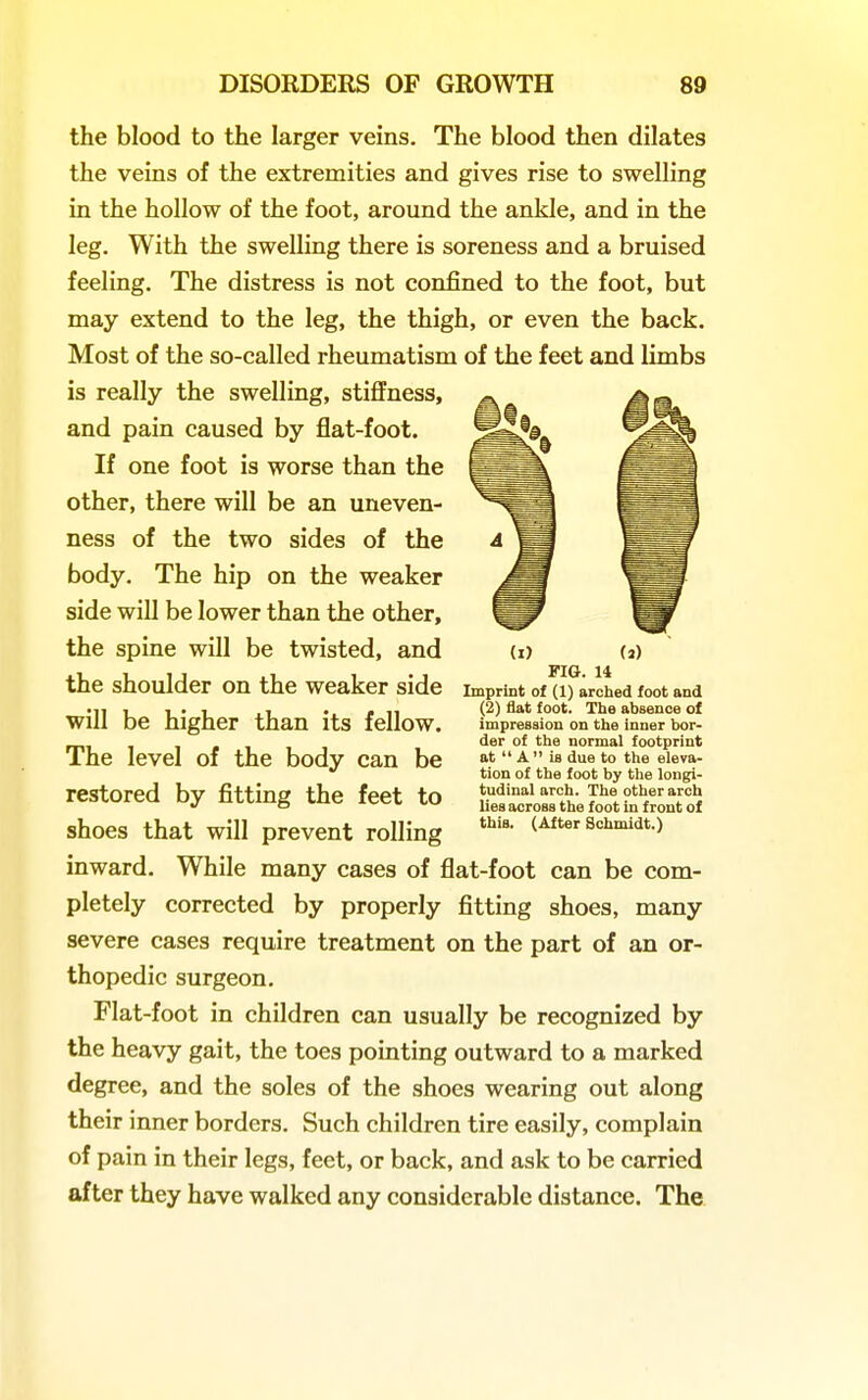 the blood to the larger veins. The blood then dilates the veins of the extremities and gives rise to swelling in the hollow of the foot, around the ankle, and in the leg. With the swelling there is soreness and a bruised feeling. The distress is not confined to the foot, but may extend to the leg, the thigh, or even the back. Most of the so-called rheumatism of the feet and limbs is really the swelling, stiffness, and pain caused by flat-foot. If one foot is worse than the other, there will be an uneven- ness of the two sides of the body. The hip on the weaker side will be lower than the other, the spine will be twisted, and the shoulder on the weaker side will be higher than its fellow. The level of the body can be restored by fitting the feet to shoes that will prevent rolling inward. While many cases of flat-foot can be com- pletely corrected by properly fitting shoes, many severe cases require treatment on the part of an or- thopedic surgeon. Flat-foot in children can usually be recognized by the heavy gait, the toes pointing outward to a marked degree, and the soles of the shoes wearing out along their inner borders. Such children tire easily, complain of pain in their legs, feet, or back, and ask to be carried after they have walked any considerable distance. The (I) (a) FIG. 14 Imprint of (1) arched foot and (2) flat foot. The absence of impression on the inner bor- der of the normal footprint at A ia due to the eleva- tion of the foot by the longi- tudinal arch. The other arch lies across the foot in front of this. (After Schmidt.)