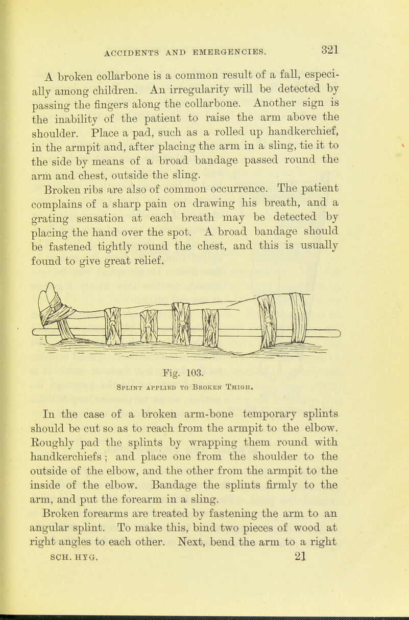 A broken collarbone is a common result of a fall, especi- ally among cbildi'en. An irregularity will be detected by passing the fingers along the collarbone. Another sign is the inability of the patient to raise the arm above the shoulder. Place a pad, such as a rolled up handkerchief, in the armpit and, after placing the arm in a sling, tie it to the side by means of a broad bandage passed round the arm and chest, outside the sling. Broken ribs are also of common occurrence. The patient complains of a sharp pain on drawing his breath, and a grating sensation at each breath may be detected by placing the hand over the spot. A broad bandage should be fastened tightly round the chest, and this is usually found to give great relief. Fig. 103. Splint applied to Broken Thigh. In the case of a broken arm-bone temporary splints should be cut so as to reach from the armpit to the elbow. Roughly pad the splints by wrapping them round with handkerchiefs ; and place one from the shoulder to the outside of the elbow, and the other from the armpit to the inside of the elbow. Bandage the splints firmly to the arm, and put the forearm in a sling. Broken forearms are treated by fastening the arm to an angular splint. To make this, bind two pieces of wood at right angles to each other. Next, bend the arm to a right SCH. HYG, 21