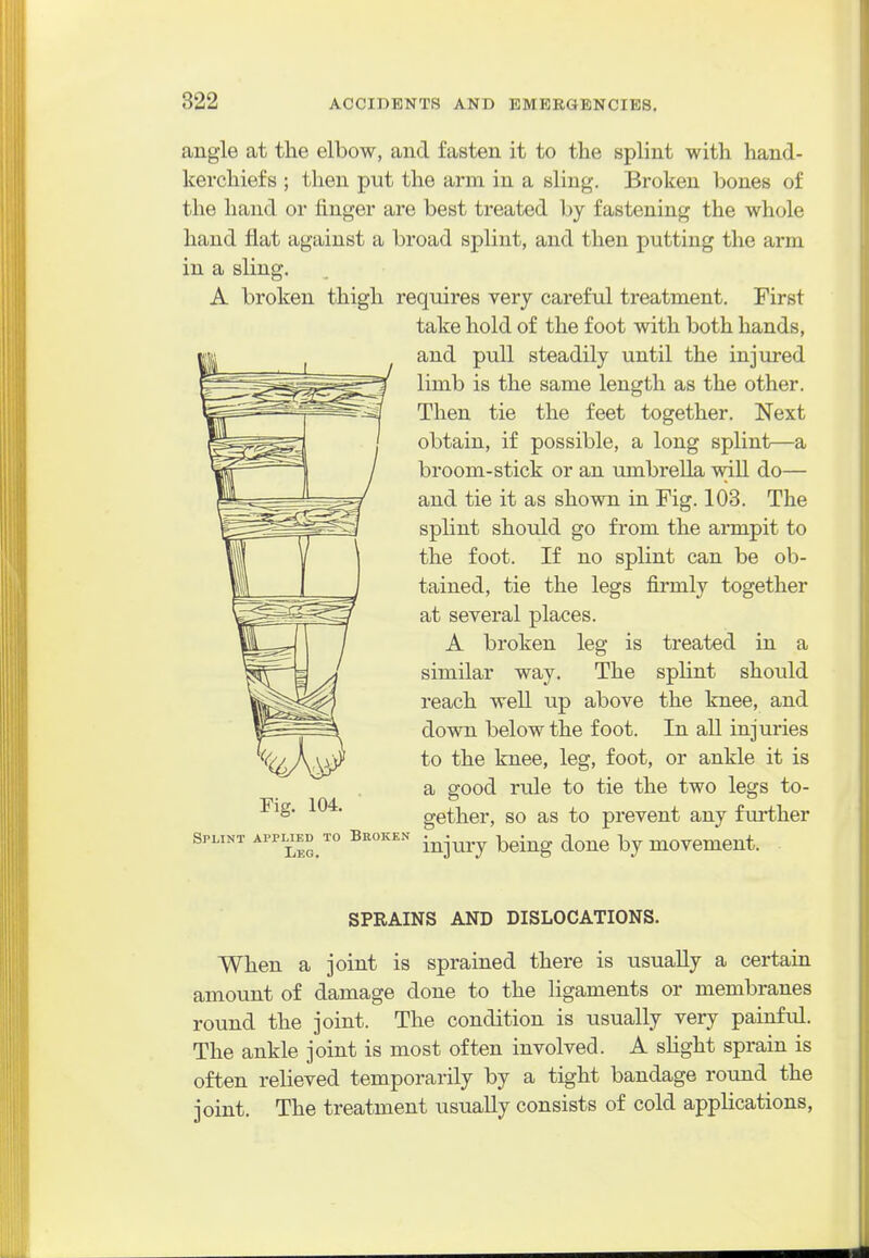 822 angle at the elbow, and fasten it to the splint with hand- kerchiefs ; then put the arm in a sling. Broken bones of the hand or finger are best treated by fastening the whole hand flat against a broad splint, and then putting the arm in a sling. A broken thigh requires very careful treatment. First take hold of the foot with both hands, and pull steadily until the injured limb is the same length as the other. Then tie the feet together. Next obtain, if possible, a long splint—a broom-stick or an umbrella wiU do— and tie it as shown in Pig. 103. The splint should go from the armpit to the foot. If no splint can be ob- tained, tie the legs firmly together at several places. A broken leg is treated in a similar way. The splint should reach well up above the knee, and down below the foot. In all injuries to the knee, leg, foot, or ankle it is a good rule to tie the two legs to- gether, so as to prevent any further injury being done by movement. rig. 104. Splint applied to BaoKEN Leg. SPRAINS AND DISLOCATIONS. When a joint is sprained there is usually a certain amount of damage done to the ligaments or membranes round the joint. The condition is usually very painful. The ankle joint is most often involved. A sHght sprain is often relieved temporarily by a tight bandage round the joint. The treatment usually consists of cold appHcations,