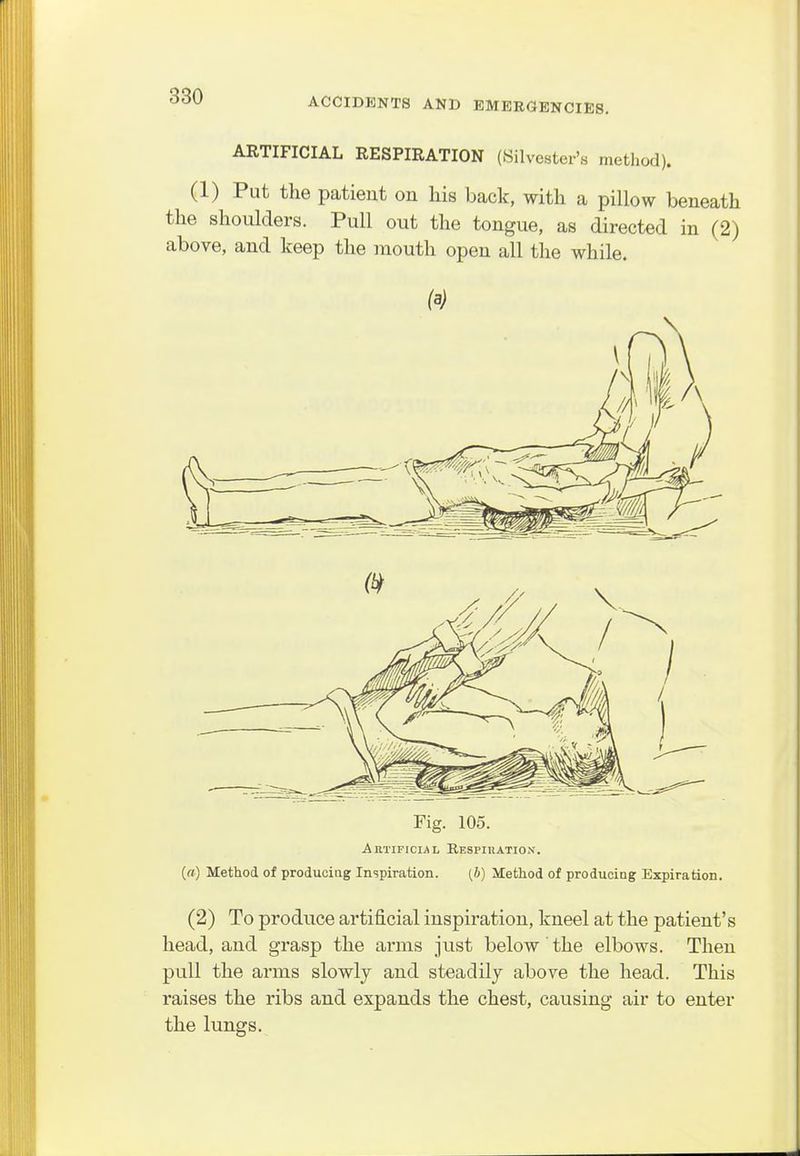 ARTIFICIAL RESPIRATION (Silvester's method). (1) Put the patient on his back, with a pillow beneath the shoulders. Pull out the tongue, as directed in (2) above, and keep the mouth open all the while. Fig. 105. Am'ificial Respiuation. («) Method of produciag Inspiration. (6) Method of producing Expiration. (2) To produce artificial inspiration, kneel at the patient's head, and grasp the arms just below the elbows. Then pull the arms slowly and steadily above the head. This raises the ribs and expands the chest, causing air to enter the lungs.