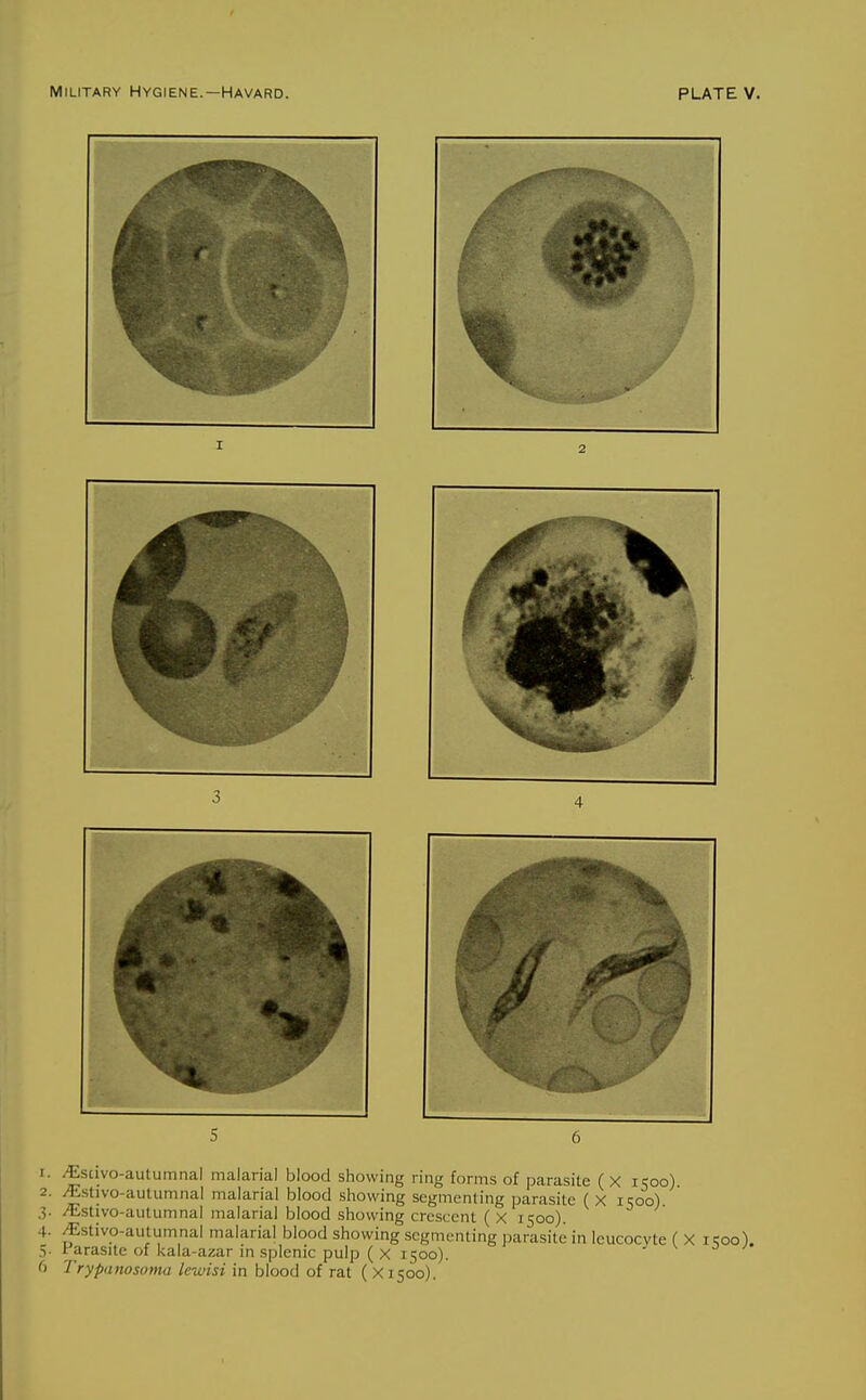 1. ^scivo-autumnal malarial blood showing ring forms of parasite ( X 1500). 2. ^sUvo-autiimnal malarial blood showing segmenting parasite ( X 1500) 3. ^stivo-aulumnal malarial blood showing crescent ( X 1500). 4. /Estivo-autumnal malarial blood showing segmenting parasite in leucocyte ( X i?oo). 5- Parasite of kala-azar in splenic pulp ( X 1500). 6 Trypanosoma lewisi in blood of rat ( X1500).