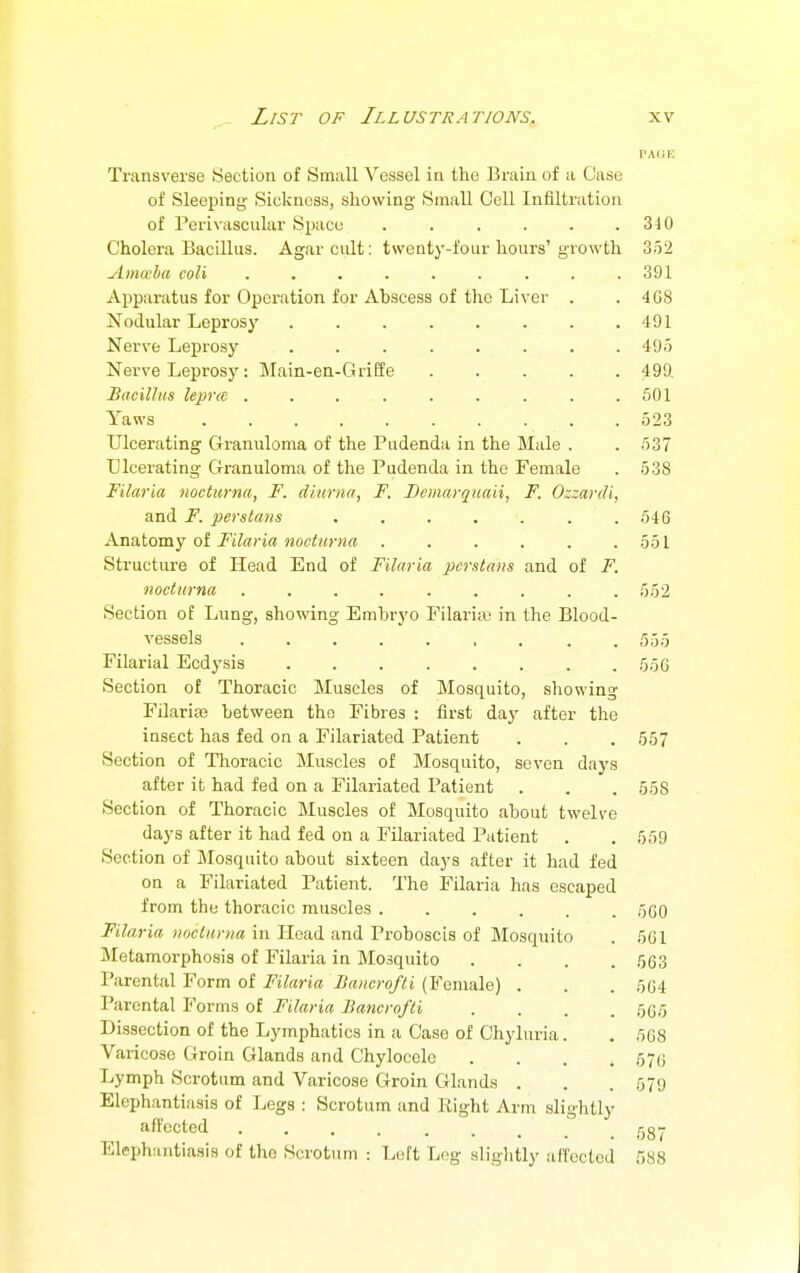 Transverse Section of Small Vessel in the Brain of a Case of Sleeping Sickness, showing Small Cell Infiltration of Perivascular Space ...... Cholera Bacillus. Agar cult: twenty-four hours' growth Ama'lia coli ......... Apparatus for Operation for Abscess of the Liver . Nodular Leprosy Nerve Leprosy ........ Nerve Leprosy : Main-ea-Griffe Bacillus lepra ......... Yaws Ulcerating Granuloma of the Pudenda in the Male . Ulcerating Granuloma of the Pudenda in the Female Filaria nocturna, F. diuriia, F. Bemarquaii, F. Ozzardi, and F. perstans . Anatomy of Filaria nocttirna ...... Structiu-e of Head End of Filaria perstans and of F. nocturna ......... Section of Lung, showing Embryo Filariti? in the Blood- vessels , . . . Filarial Ecdysis Section o£ Thoracic Muscles of Mosquito, showing FilarisB between the Fibres : first day after the insect has fed on a Filariated Patient Section of Thoracic Muscles of Mosquito, seven days after it had fed on a Filariated Patient Section of Thoracic Muscles of Mosquito about twelve days after it had fed on a Filariated Patient . Section of Mosquito about si.xteen days after it had fed on a Filariated Patient. The Filaria has escaped from the thoracic muscles Filaria nocturna in Head and Proboscis of Mosquito Metamorphosis of Filaria in Mosquito Parental Form of Filaria Bancrofti (Female) . Parental Forms of Filaria Bancrofti Dissection of the Lymphatics in a Case of Chyluria Varicose Groin Glands and Chylocele Lymph Scrotum and Varicose Groin Glands . Elephantiasis of Legs : Scrotum and Right Arm slightly affected Elephantiasis of the Scrotum 310 352 391 408 491 495 499. 601 523 537 538 546 551 552 555 556 557 558 559 560 501 503 564 505 508 576 579 Left Log sliglitly affected 587 588