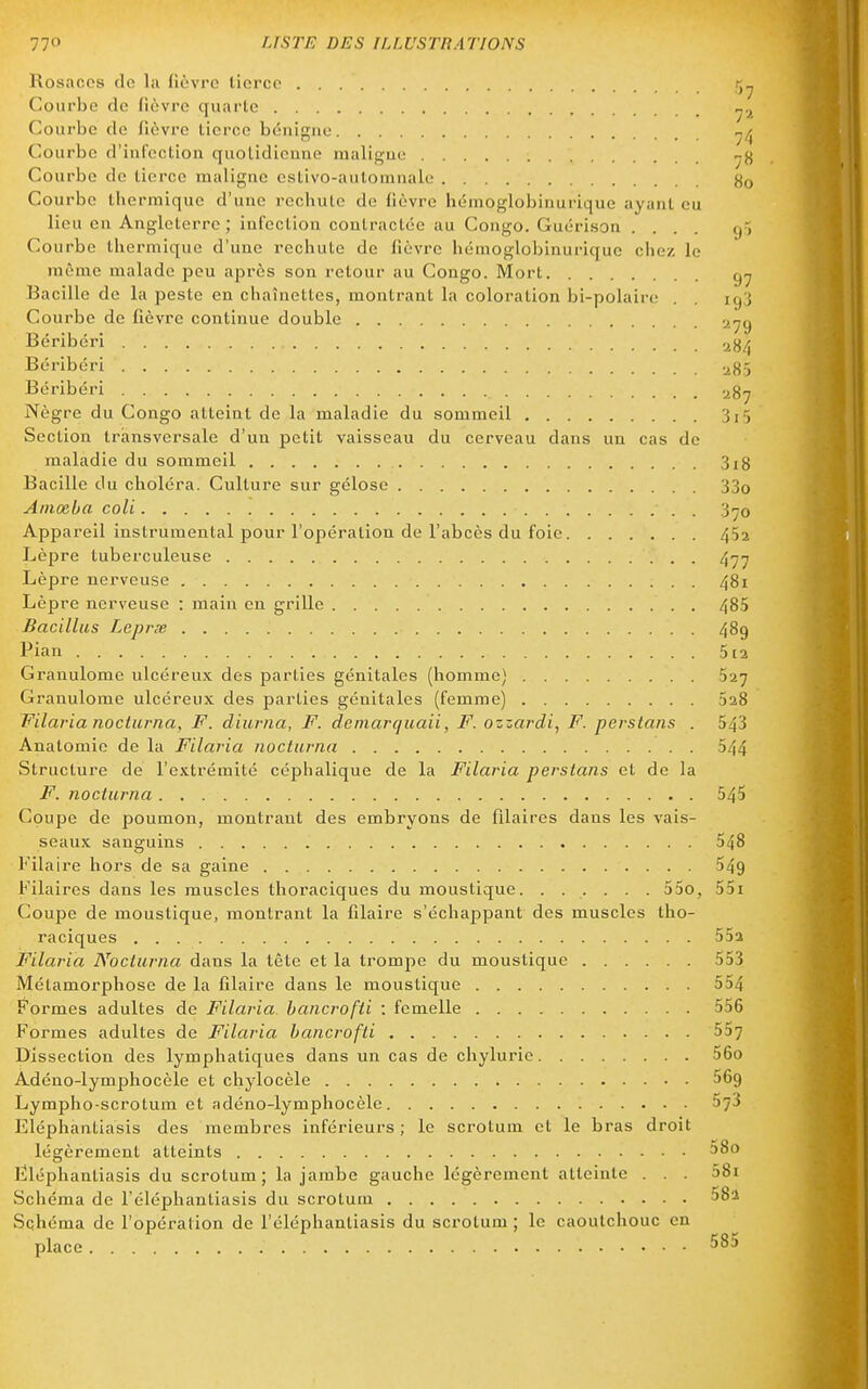 lios.accs do la (ièvro tierce r,^ Courbe de (icvro quarte ^.^ Courbe de (lèvre tierce bénigne Courbe d'infection quotidienne maligne Courbe de tierce maligne estivo-aulomnale Courbe thermique d'une rechute de fièvre hémoglobinurique ayant eu lieu en Angleterre ; infection contractée au Congo. Guérison .... g, Courbe thermique d'une rechute de fièvre hémoglobinurique chez le même malade peu après son retour au Congo. Mort Bacille de la peste en chaînettes, montrant la coloration bi-polaire . , ig3 Courbe de fièvre continue double Béribéri Béribéri .^85 Béribéri 287 Nègre du Congo atteint de la maladie du sommeil 3i ', Section transversale d'un petit vaisseau du cerveau dans un cas de maladie du sommeil 3ig Bacille du choléra. Culture sur gélose 33o Ainœba coli 3^0 Appareil instrumental pour l'opération de l'abcès du foie 452 Lèpre tuberculeuse Lèpre nerveuse 481 Lèpre nerveuse : main en grille 485 Bacillus Leprx 489 Pian 5 [2 Granulome ulcéreu.x des parties génitales (homme) 527 Granulome ulcéreux des parties génitales (femme) 5a8 Filaria nocturna, F. diurna, F. demarquaii, F. ozzaj-di, F. perstans . 543 Anatomie de la Filavia nocturna 544 Structure de l'extrémité céphalique de la Filaria perstans et de la F. nocturna 545 Coupe de poumon, montrant des embryons de filaires dans les vais- seaux sanguins 548 l' ilaire hors de sa gaine 549 Filaires dans les muscles thoraciques du moustique. ...... 55o, 55i Coupe de moustique, montrant la Glaire s'échappant des muscles tho- raciques 552 Filaria Nocturna dans la tète et la trompe du moustique 553 Métamorphose de la filaire dans le moustique 554 ^'ormes adultes de Filaria. hancrofti : femelle 556 Formes adultes de Filaria hancrofti 557 Dissection des lymphatiques dans un cas de chylurie 56o Adéno-lymphocèle et chylocèle 569 Lympho-scrotum et adéno-lymphocèle 573 Eléphantiasis des membres inférieurs ; le scrotum et le bras droit légèrement atteints 58o Fléphantiasis du scrotum; la jambe gauche légèrement atteinte . . . 58i Schéma de l'éléphantiasis du scrotum 58î Schéma de l'opération de l'éléphantiasis du scrotum ; le caoutchouc en place