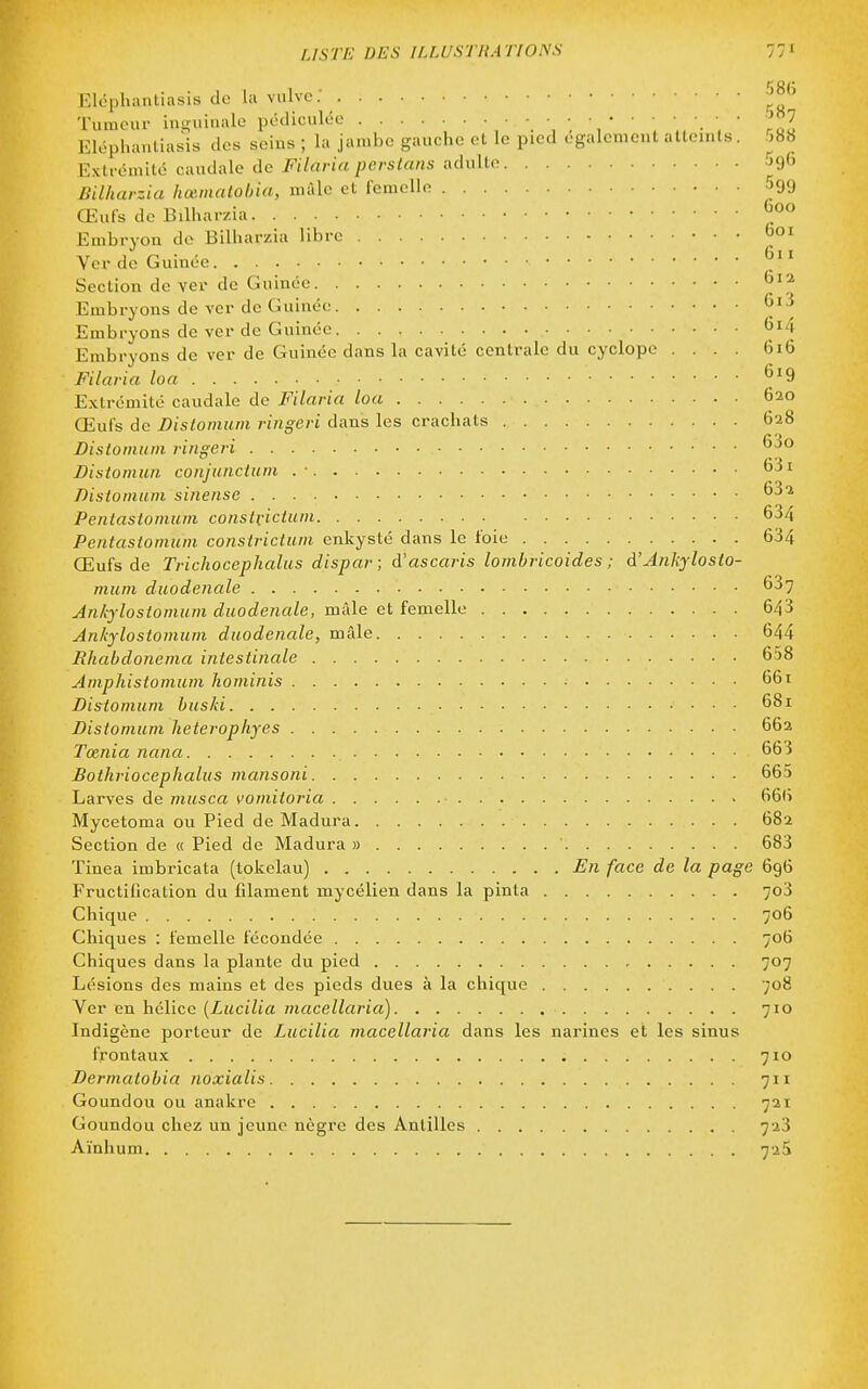 :)8(; Eléphantiasis de la vulve; Tumeur inguinale pédiculée [J. Eléphantiasis des seins ; la jambe gauche et le pied ogalcnient atteints. 588 Extrémité caudale de Filaria perstaiis adulte Sg^' Bilharzia hœmalobia, màlc et femelle -^^99 Œufs de Bilharzia Embryon do Bilharzia libre Soi Ver de Guinée Section de ver de Guinée tiia Embryons de ver de Guinée 6i3 Embryons de ver de Guinée *^i4 Embryons de ver de Guinée dans la cavité centrale du cyclope .... 6x6 Filaria loa 619 Extrémité caudale de Filaria loa 620 Œufs de Dislomum ringcri dans les crachats 6-28 Dislomum ringeri Distomun conjuncium .- 631 Dislomum siiiense ^S-i Penlaslomum constriclum 634 Pentastomum consiriclum enkysté dans le foie 634 Œufs de Trichocephalus dispar ; d'ascaris lombricoides ; d'Ankyloslo- mum duodenale 637 Ankyloslomuin duodenale, mâle et femelle 643 Ankyloslomuin duodenale, mâle 644 Rhabdonema intestinale 658 Amphistonium hominis • 661 Dislomum bus/d 681 Distomum heterophyes 662 Tœnia nana 663 Bothriocephalus mansoni 665 Larves de musca vomiloria 666 Mycetoma ou Pied de Madura 682 Section de « Pied de Madura » 683 ïinea imbricata (tokelau) En face de la page 696 Fructification du filament mycélien dans la pinta 7o3 Chique 706 Chiques : femelle fécondée 706 Chiques dans la plante du pied 707 Lésions des mains et des pieds dues à la chique 708 Yer en hélice (Lucilia macellaria) 710 Indigène porteur de Lucilia macellaria dans les narines et les sinus frontaux 710 Dermalobia noxialis 711 Goundou ou anakre 721 Goundou chez un Jeune nègre des Antilles 723 Aïnhum 72S