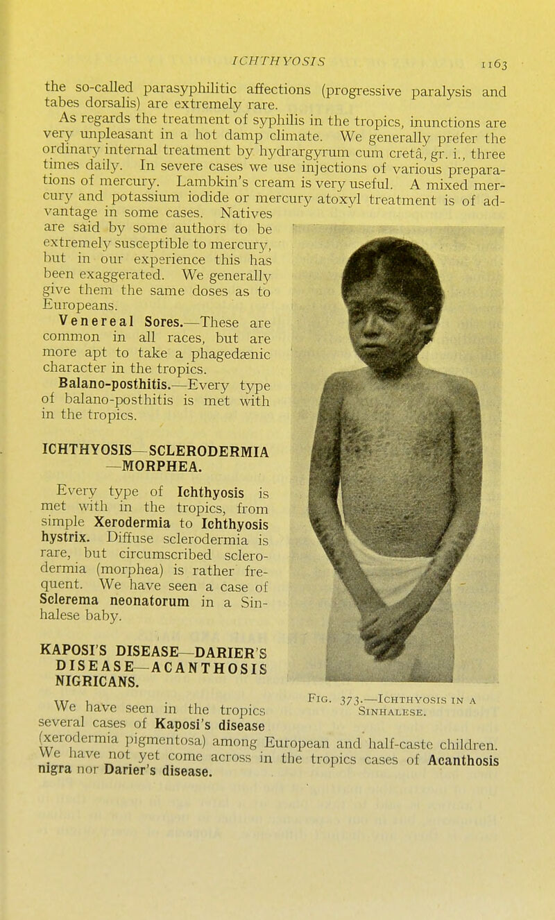 ICHTHYOSIS the so-called parasyphilitic affections (progressive paralysis and tabes dorsalis) are extremely rare. As regards the treatment of syphilis in the tropics, inunctions are very unpleasant in a hot damp climate. We generally prefer the ordinary internal treatment by hydrargyrum cum creta, gr. i., three times daily. In severe cases we use injections of various prepara- tions of mercury. Lambkin's cream is very useful. A mixed mer- cury and potassium iodide or mercury atoxyl treatment is of ad- vantage in some cases. Natives are said by some authors to be extremely susceptible to mercury, but in our experience this has been exaggerated. We generally give them the same doses as to Europeans. Venereal Sores.—These are common in all races, but are more apt to take a phagedasnic character in the tropics. Balano-posthitis.—Every type of balano-posthitis is met with in the tropics. ICHTHYOSIS— SCLERODERMIA —MORPHEA. Every type of Ichthyosis is met with in the tropics, from simple Xerodermia to Ichthyosis hystrix. Diffuse sclerodermia is rare, but circumscribed sclero- dermia (morphea) is rather fre- quent. We have seen a case of Sclerema neonatorum in a Sin- halese baby. KAPOSI'S DISEASE—DARIER'S DISEASE—ACANTHOSIS NIGRICANS. Fig. 373.—Ichthyosis in a Sinhalese. We have seen in the tropics several cases of Kaposi's disease (xerodermia pigmentosa) among European and' half-caste children, vye have not yet come across in the tropics cases of Acanthosis nigra nor Darier's disease.