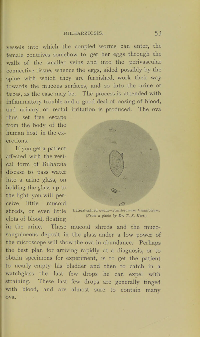vessels into which the coupled worms can enter, the female contrives somehow to get her e^gs through the walls of the smaller veins and into the perivascular connective tissue, whence the eggs, aided possibly by the spine with which they are furnished, work their way towards the mucous surfaces, and so into the urine or fasces, as the case may be. The process is attended with inflammatory trouble and a good deal of oozing of blood, and urinary or rectal irritation is produced. The ova thus set free escape from the body of the human host in the ex- cretions. If you get a patient affected with the vesi- cal form of Bilharzia disease to pass water into a urine glass, on holding the glass up to the light you will per- ceive little mucoid shreds, or even little clots of blood, floating in the urine. These mucoid shreds and the muco- sanguineous deposit in the glass under a low power of the microscope will show the ova in abundance. Perhaps the best plan for arriving rapidly at a diagnosis, or to obtain specimens for experiment, is to get the patient to nearly empty his bladder and then to catch in a watchglass the last few drops he can expel with straining. These last few drops are generally tinged with blood, and are almost sure to contain many ova. Lateral-spined ovum—Schistosomum hcematobium. {From a photo by Dr. T. S. Kerr.)