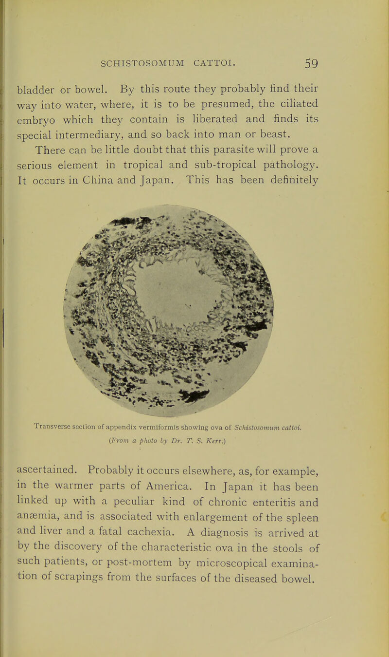 bladder or bowel. By this route they probably find their way into water, where, it is to be presumed, the ciliated embryo which they contain is liberated and finds its special intermediary, and so back into man or beast. There can be little doubt that this parasite will prove a serious element in tropical and sub-tropical pathology. It occurs in China and Japan. This has been definitely Transverse section of appendix veiniilormis showing ova of Scltistosomum cattoi. {From a photo by Dr. T. S. Kerr.) ascertained. Probably it occurs elsewhere, as, for example, in the warmer parts of America. In Japan it has been linked up with a peculiar kind of chronic enteritis and anaemia, and is associated with enlargement of the spleen and liver and a fatal cachexia. A diagnosis is arrived at by the discovery of the characteristic ova in the stools of such patients, or post-mortem by microscopical examina- tion of scrapings from the surfaces of the diseased bowel.