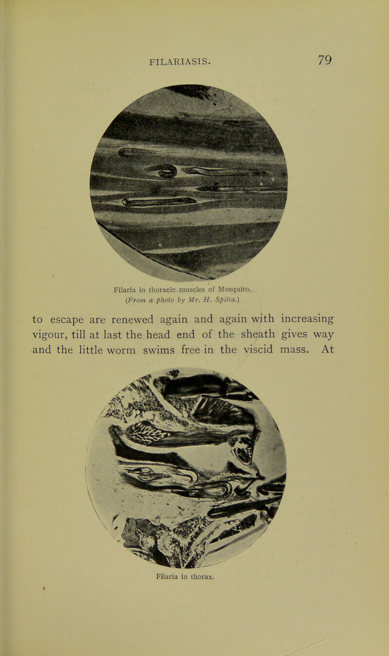 Filaria in thoracic muscles of Mosquito. {From a photo by Mr. H. Spitta.) to escape are renewed again and again with increasing vigour, till at last the head end of the sheath gives way and the little worm swims free in the viscid mass. At Filaria in thorax.