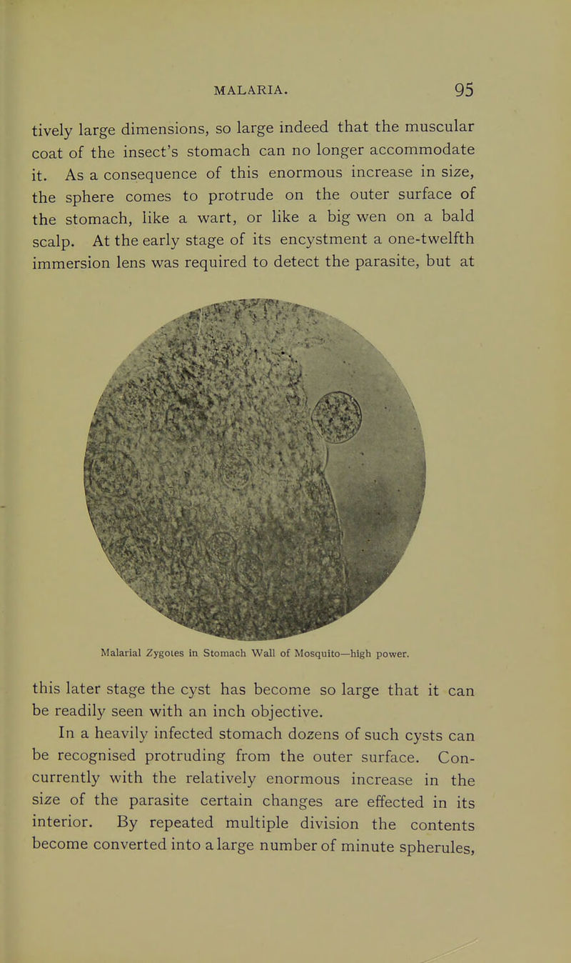 tively large dimensions, so large indeed that the muscular coat of the insect's stomach can no longer accommodate it. As a consequence of this enormous increase in size, the sphere comes to protrude on the outer surface of the stomach, like a wart, or like a big wen on a bald scalp. At the early stage of its encystment a one-twelfth immersion lens was required to detect the parasite, but at Malarial Zygotes in Stomach Wall of Mosquito—high power. this later stage the cyst has become so large that it can be readily seen with an inch objective. In a heavily infected stomach dozens of such cysts can be recognised protruding from the outer surface. Con- currently with the relatively enormous increase in the size of the parasite certain changes are effected in its interior. By repeated multiple division the contents become converted into a large number of minute spherules,