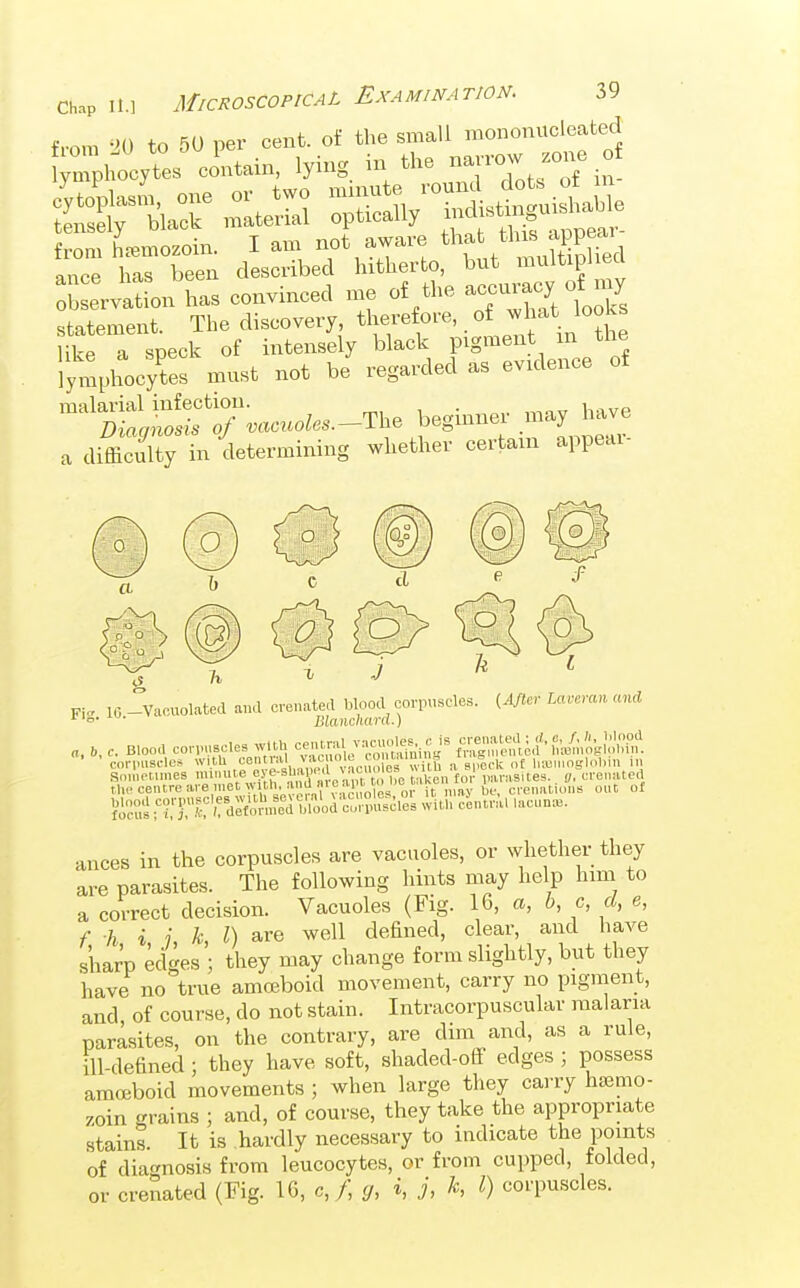 Ob ervat on has couvinced me of the ac-racj of statement. The discovery, therefore, of -1-^^ ^^^^ like a speck of intensely black pigment in the lymphocytes must not be regarded as evidence of malarial infection. rr,, i • ,. ,.-,nv Ivive Diagnosis of vacuoles.-The beginner /^^^J '^^^ a difficulty in determining whether certain appeai- Fi. 10-Vacuolated and creuated blood corpuscle.. U/tcv Lavemn and a, b, c. Blood corimseles wHb central^:—^^dl^'f^J^^^^^'il^. corpuscles wi.tU «en ™1 v.iuu.le co^ ^ lueinoglnbm in Sometimes ^.^f'SliW^^^ jo,! parasites.. ff, crenated tlK-ceiUreare met wi h. and^^ . ^ crenatioiis out of ficus ffc'fdeVo%ed WoU co^^^ with central lacuna. ances in the corpuscles are vacuoles, or whether they are parasites. The following hints may help him to a correct decision. Vacuoles (Fig. 16, a, b, c, d, e, f h i j k I) are well defined, clear, and have sharp edges ; they may change form slightly, but they have no true amceboid movement, carry no pigment, and, of course, do not stain. Intracorpuscular malaria parasites, on the contrary, are dim and, as a rule, ill-defined; they have soft, shaded-off edges ; possess amoeboid movements ; when large they carry hsemo- zoin grains ; and, of course, they take the appropriate stains. It is hardly necessary to indicate the points of diaf'nosis from leucocytes, or from cupped, folded, or crenated (Fig. 16, c, /, cj, i, j, k, I) corpuscles.