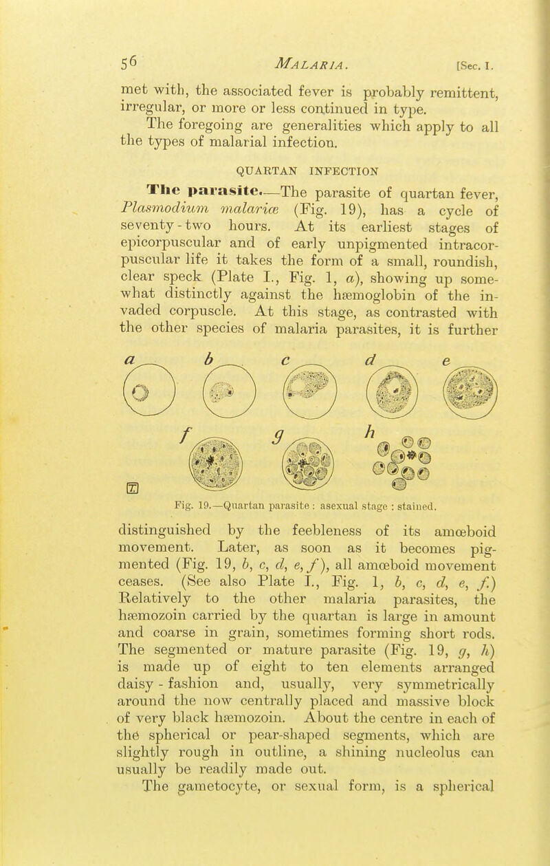 met with, the associated fever is probably remittent, irregular, or more or less continued in type. The foregoing are generalities which apply to all the types of malarial infection. QUARTAN INFECTION The parasite—The parasite of quartan fever, Plasmodium onalarice (Fig. 19), has a cycle of seventy-two hours. At its earliest stages of epicorpuscular and of early unpigmented intracor- puscular life it takes the form of a small, roundish, clear speck (Plate I., Fig. 1, a), showing up some- what distinctly against the hfemoglobin of the in- vaded corpuscle. At this stage, as contrasted with the other species of malaria parasites, it is further Fig. 19.—Quartan parasite : asexual stage : stained. distinguished by the feebleness of its amoeboid movement. Later, as soon as it becomes pig- mented (Fig. 19, b, c, d, e,/), all amoeboid movement ceases. (See also Plate I., Fig. 1, b, c, d, e, f.) Relatively to the other malaria parasites, the hsemozoin carried by the quartan is large in amount and coarse in grain, sometimes forming short rods. The segmented or mature parasite (Fig. 19, g, h) is made up of eight to ten elements arranged daisy - fashion and, usuallj', very symmetrically around the now centrally placed and massive block of very black hsemozoin. About the centre in each of the spherical or pear-shaped segments, which are slightly rough in outline, a shining nucleolus can usually be readily made out. The gametocyte, or sexual form, is a spherical