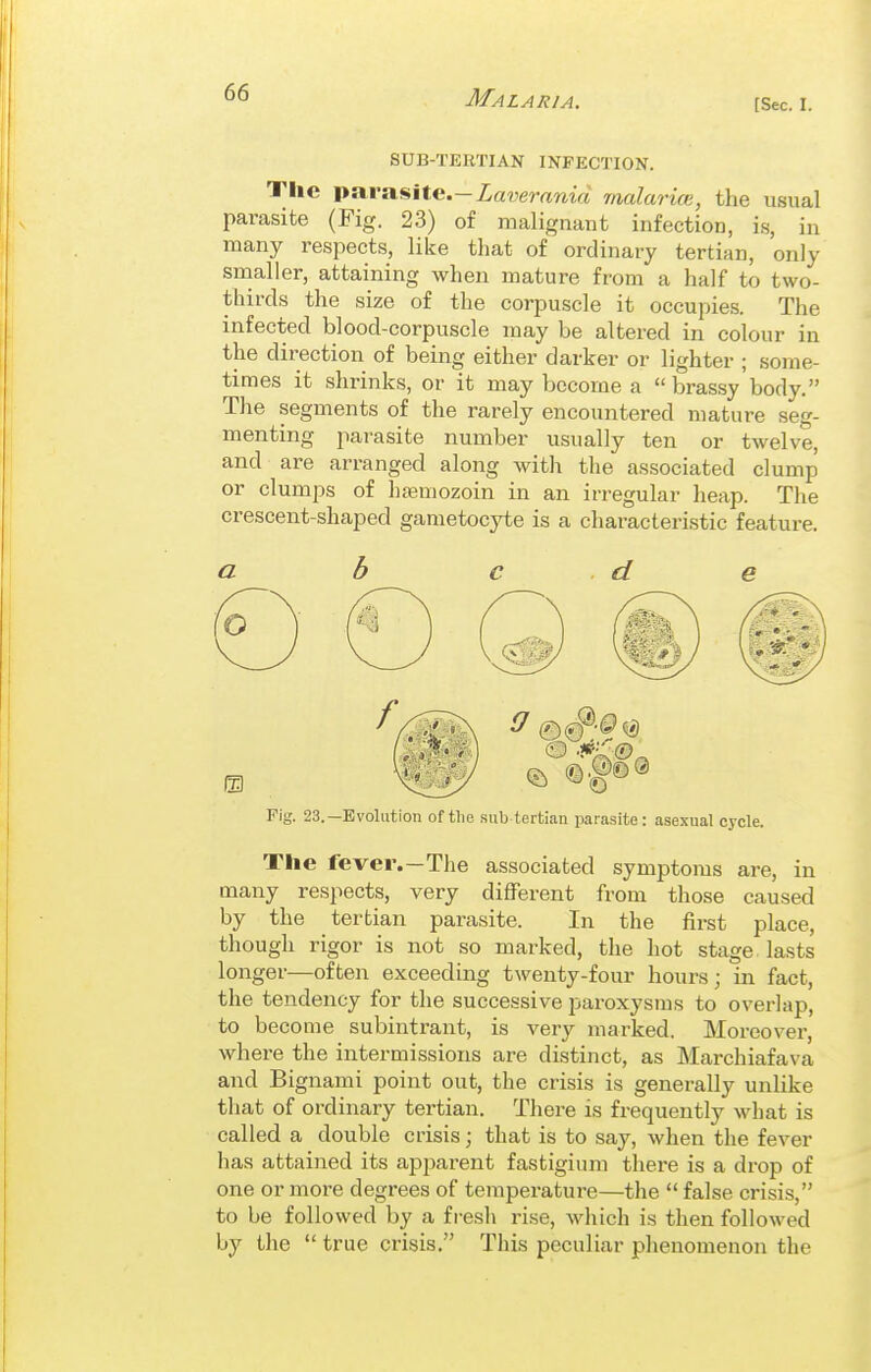 [Sec. I. SUB-TEUTIAN INFECTION. The parasite.—Zavemma malarice, the usual parasite (Pig. 23) of malignant infection, is, in many respects, like that of ordinary tertian, only snialler, attaining when mature from a half to two- thirds the size of the corpuscle it occupies. The infected blood-corpuscle may be altered in colour in the direction of being either darker or lighter ; some- times it shrinks, or it may become a brassy body. The segments of the rarely encountered mature seg- menting parasite number usually ten or twelve, and are arranged along with the associated clump or clumps of hjemozoin in an irregular heap. The crescent-shaped gametocyte is a characteristic feature. a b c d e Fig. 23.—Evolution of tlie .sub tertian parasite: asexual cycle. The fever.—The associated symptoms are, in many respects, very different from those caused by the tertian parasite. In the first place, though rigor is not so marked, the hot stage lasts longer—often exceeding twenty-four hours; in fact, the tendency for the successive paroxysms to overlap, to become subintrant, is very marked. Moreover, where the intermissions are distinct, as Marchiafava and Bignami point out, the crisis is generally unlike that of ordinary tertian. There is frequently what is called a double crisis; that is to say, when the fever has attained its apparent fastigium there is a drop of one or more degrees of temperature—the  false crisis, to be followed by a fresh rise, which is then followed by the  true crisis. This peculiar phenomenon the