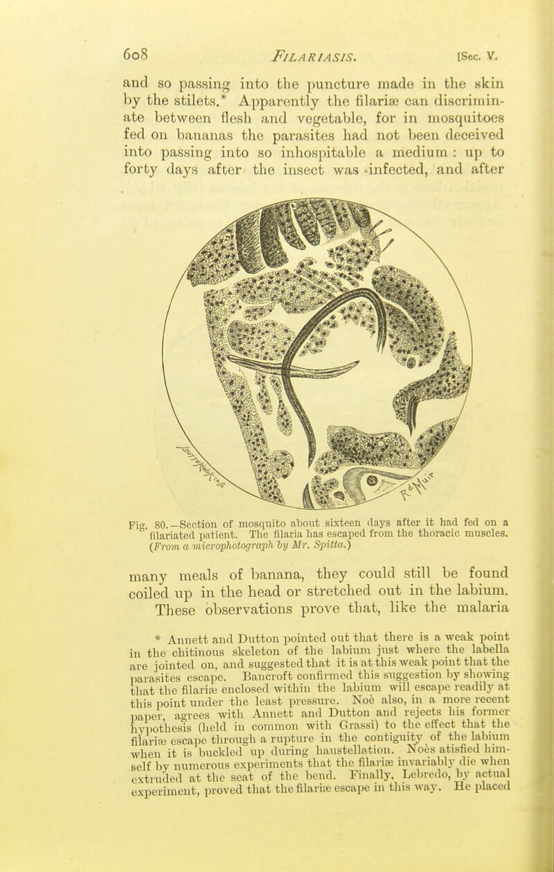 and so passing into the puncture made in the skin by the stilets.* Apparently the filarise can discrimin- ate between flesli and vegetaVjle, for in mosquitoes fed on bananas the parasites had not beeii deceived into passing into so inhospitable a medium : up to forty days after the insect was -infected, and after Fig. 80.—Section of mosquito about sixteen days after it had fed on a filariated patient. The filaria has escaped from the thoracic muscles. {From a micropliotograph by Mr. Spitta.) many meals of banana, they could still be found coiled up in the head or stretched out in the labium. These observations prove that, like the malaria * Aniiett and Button pointed out that there is a weak point in the chitinous skeleton of the labium just where the labella are jointed on, and suggested that it is at this weak point that the parasites escape. Bancroft confirmed this suggestion by sliowing tliat the f]la,ria! enclosed within the labium will escape readily at this point under the least pressure. NotJ also, in a more recent paper agrees with Annett and Button and rejects his former hypothesis (held in common with Grassi) to the effect that the filaria; escape through a rupture in the contiguity of the labium when it is budded up during haustellation. No^s atisfied him- self by numerous experiments that the filarise invariably die wlien extruded at the seat of tlie liend. Finally, Lcbredo, by actual experiment, proved that the filaria; escape in this way. He placed