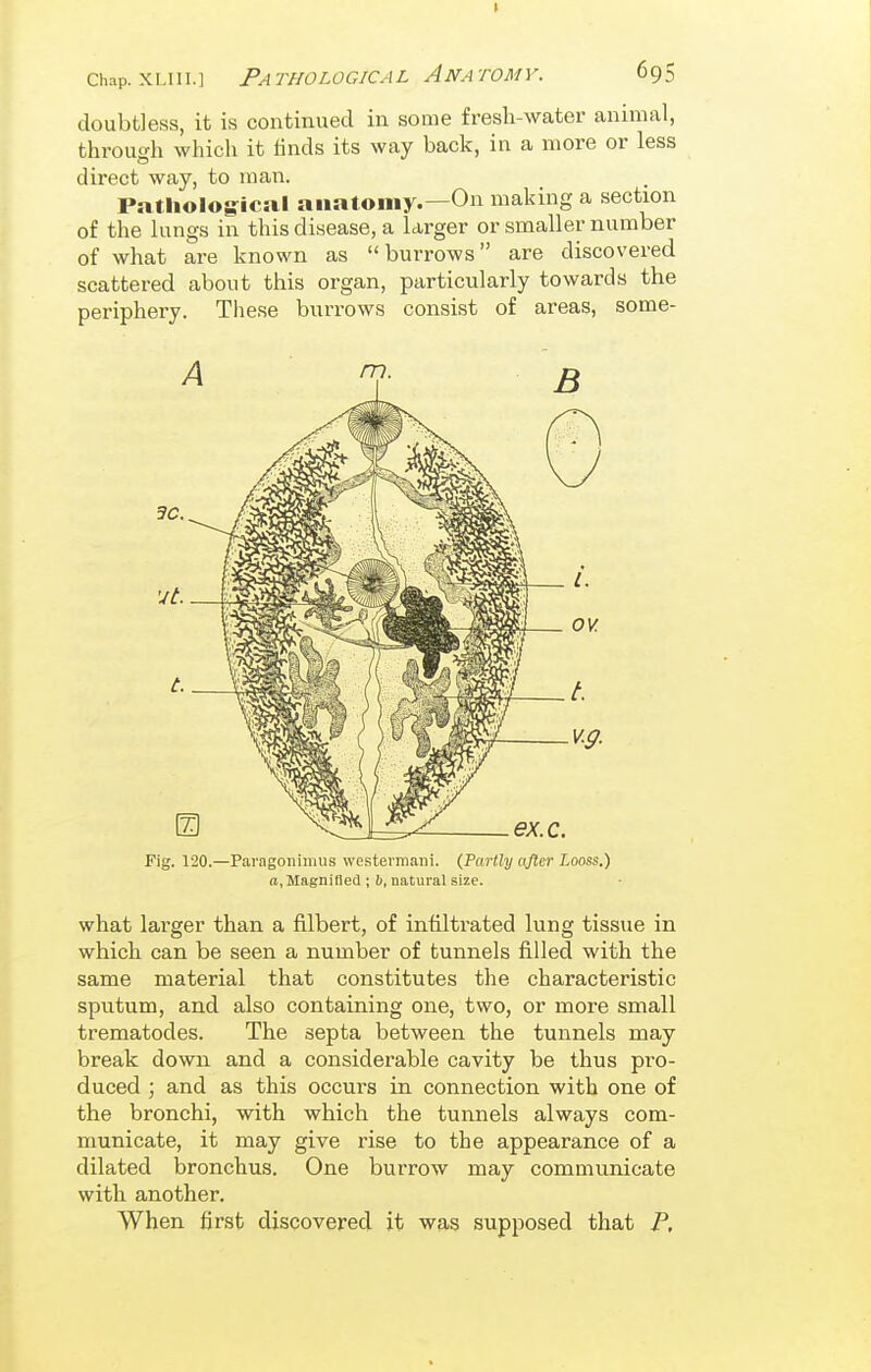 doubtless, it is continued in some fresh-water animal, through which it finds its way back, in a more or less direct way, to man. Pathological anatomy.—On making a section of the lungs in this disease, a larger or smaller number of what are known as burrows are discovered scattered about this organ, particularly towards the periphery. These burrows consist of areas, some- Fig. 120.—Paragoiiimus westermani. (Partly ctfter Looss.) (I,Magnified ; b, natural size. what larger than a filbert, of infiltrated lung tissue in which can be seen a number of tunnels filled with the same material that constitutes the characteristic sputum, and also containing one, two, or more small trematodes. The septa between the tunnels may break down and a considerable cavity be thus pro- duced ; and as this occurs in connection with one of the bronchi, with which the tunnels always com- municate, it may give rise to the appearance of a dilated bronchus. One burrow may communicate with another. When first discovered it was supposed that P.