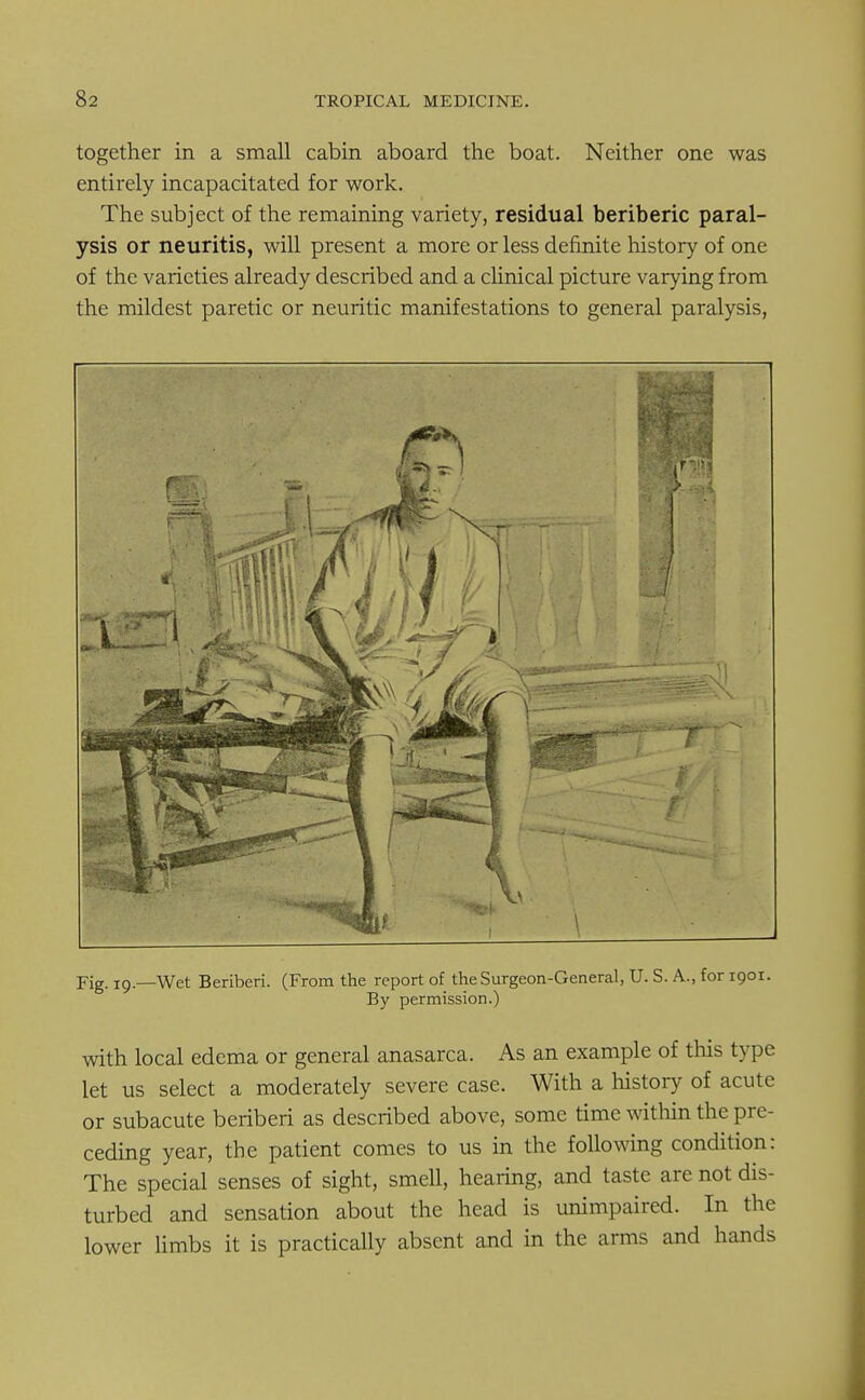 together in a small cabin aboard the boat. Neither one was entirely incapacitated for work. The subject of the remaining variety, residual beriberic paral- ysis or neuritis, will present a more or less definite history of one of the varieties already described and a clinical picture varying from the mildest paretic or neuritic manifestations to general paralysis, Fig. 19—Wet Beriberi. (From the report of the Surgeon-General, U. S. A., for 1901. By permission.) with local edema or general anasarca. As an example of this type let us select a moderately severe case. With a history of acute or subacute beriberi as described above, some time within the pre- ceding year, the patient comes to us in the following condition: The special senses of sight, smell, hearing, and taste are not dis- turbed and sensation about the head is unimpaired. In the lower limbs it is practically absent and in the arms and hands