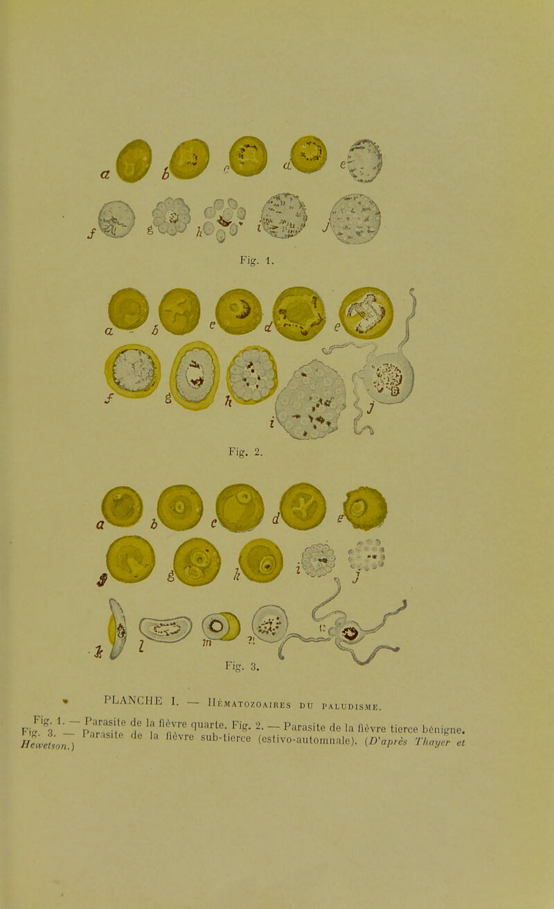 Fisr. 1. Fig. 2. ^ % ' Fis- 3. » PLANCHE I. — IIÉMATozoAinEs du paludisme. Fi^-s ''-TpaTiftl' t quarte Fig. 2. _ Parasite de la f.èvre tierce bc^ni,me. HcJtson 1 sub-t.erce (estivo-aulomnale). [Diaprés Thayer et