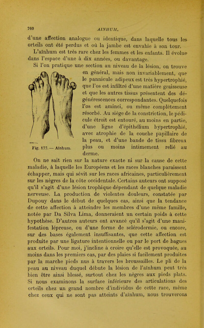 '60 AINHUM. d'une affection analogue ou identique, dans laquelle tous les orteils ont été perdus et où la jambe est envahie à son tour. L'aïnhum est très rare chez les femmes et les enfants. Il évolue dans l'espace d'une à dix années, ou davantage. Si l'on pratique une section au niveau de la lésion, on trouve en général, mais non invariablement, que le pannicule adipeux est très hypertrophié, que l'os est infiltré d'une matière graisseuse et que les autres tissus présentent des dé- générescences correspondantes. Quelquefois l'os est aminci, ou même complètement résorbé. Au siège de la constriction, le pédi- cule étroit est entouré, au moins en partie, d'une ligne d'épithélium hypertrophié, avec atrophie de la couche papillaire de la peau, et d'une bande de tissu fibreux Fig. 177.—Aïnhum. plus OU moins intimement relié au derme. On ne sait rien sur la nature exacte ni sur la cause de cette maladie, à laquelle les Européens et les races blanches paraissent échapper, mais qui sévit sur les races africaines, particulièrement sur les nègres de la côte occidentale. Certains auteurs ont supposé qu'il s'agit d'une lésion trophique dépendant de quelque maladie nerveuse. La production de violentes douleurs, constatée par Dupouy dans le début de quelques cas, ainsi que la tendance de cette affection à atteindre les membres d'une même famille, notée par Da Silva Lima, donneraient un certain poids à cette hypothèse. D'autres auteurs ont avancé qu'il s'agit d'une mani- festation lépreuse, ou d'une forme de sclérodermie, ou encore, sur des bases également insuffisantes, que cette affection est produite par une ligature intentionnelle ou par le port de bagues aux orteils. Pour moi, j'incline à croire qu'elle est provoquée, au moins dans les premiers cas, par des plaies si facilement produites par la marche pieds nus à travers les broussailles. Le pH de la peau au niveau duquel débute la lésion de l'aïnhum peut très bien être ainsi blessé, surtout chez les nègres aux pieds plats. Si nous examinons la surface inférieure des articulations des orteils chez un grand nombre d'individus de cette race, même chez ceux qui ne sont pas atteints d'aïnhum, nous trouverons