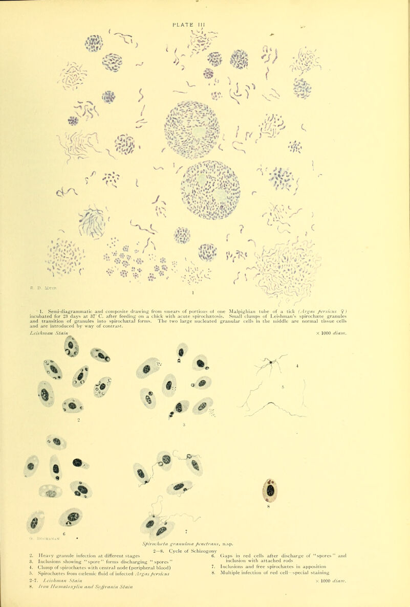 R, 1. Senii-diagraminatic and coniposite drawiiij; from smears of poriions of one Malpighiaii tube of a lick (.-i;-^'vi,v /crsicies ^) incubated for 23 daj's at 37 C. after feedin^^ on a chick with acute spirochcctosis. Small clumps of Leishman's spirochaste granules and transition of granules into spirochsetal forms. The two large nucleated granular cells in the middle are normal tissue cells and are introduced by way of contrast. Lcisluiian Stain X 1000 diajii. _J3r~ n Sp 'n'iK hu-ta t^raniilosn penetrans, n.sp. lule infection at different stages liowing spore forms discharging 2. Heavy gr 3. Inclusions shownig spore torms clischargnig spores 4. Clump of spirochajtes with central node (peripheral hlood) r>- Spiroch^^etfs frnm ciclemic ilnid of infected J/'crsicns H. fron jl(cniiiloA-ylin ami S, Jjranin Stain Cycle of Schizogony 6. (iaps in red cells after discharge of spore inclusion with attached rods Inclusions and free spirocha;tes in apposition Multiple infection of red cell- special staininy and