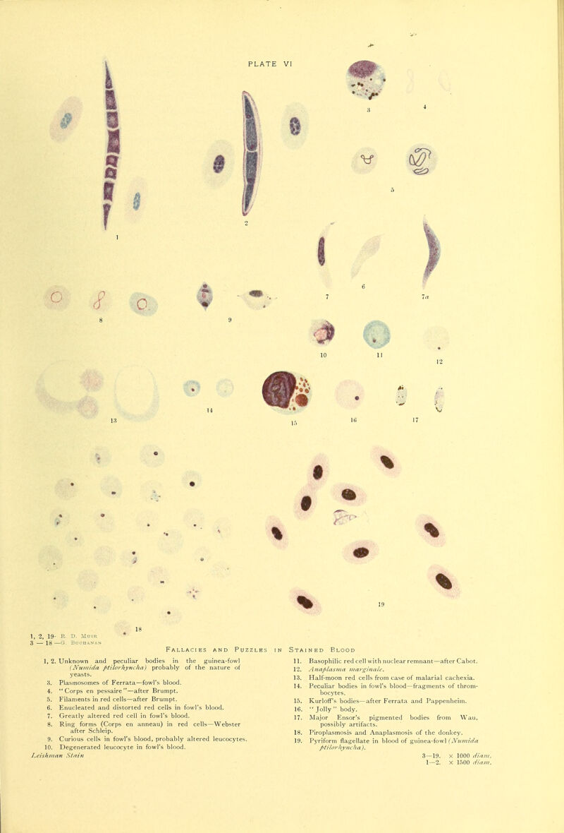 PLATE VI 1 1. 2, 19- 3 — 18 - D. Mmu BOCH&NAN Fallacies and Puzzles 1, 2. Unknown and peculiar bodies in the guinea-fowl [Nuinida ptilorhy?icha) probably of the nature of yeasts. Plasmosomes of Ferrata—fowl'is blood. Corps en pessaire—after Brumpt. Filaments in red cells—after Brumpt. Enucleated and distorted red cells in fowl's blood. Greatly altered red cell in fowl's blood. Ring forms (Corps en anneau) in red cells—Webster after Schleip. Curious cells in fowl's blood, probably altered leucocytes. Degenerated leucocyte in fowl's blood. 9. 10. I,eishiiinn Stnin StaiNED Blood 11. Basophilic red cell with nuclear remnant—after Cabot. 12. Anaplasma ;//ai-giiiale. 13. Half-moon red cells from case of malarial cachexia. 14. PecuHar bodies in fowl's blood—fragments of throm- bocytes. 15. Kurloff's bodies—after Ferrata and Pappenheim. 16.  Jolly  body. 17. Major Ensor's pigmented bodies from Wau, possibly artifacts. 18. Piroplasmosis and Anaplasmosis of the donkey. 19. Pyriform flagellate in blood of guinea-fowl fA'^/w/f/n^ ptilorhyncha). 3—19. X 1000 dinm. 1—2. X 1500 diam.