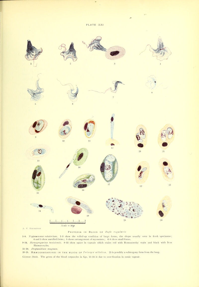 I I I I I I I 25 24 IIiiIiii[IiiiiImiiIii[[| Scn/i- = liOl^t A. C. Stevenson Protozoa in Blood of B n/o rcg;iilaris 1-8. Tiypanosoma ^'otatoriiim. 1-3 show the rolled-up condition of large forms, the shape usually seen in fresh specimens; 4 and 5 show unrolled forms ; 5 shows arrangement of myonemes ; 6-8 show small forms. U-14. JI (einogregarhia tuiiisiensis. 9-13 show space in capsule which stains red with Romano wsky stain and black with Iron Ha;matox3'lin. 15-19. l)7-epa}iidin}!i }nag?iinn, 20-25. H M O G R EG A R I N ES IN THE BLOOD OF f r I o H v X n i I o t i c a, 25 is possibl}'a schizogon} form from the lung. Gicmsn Stain. The green of the blood corpuscles in figs. 15-18 is due to over-fixation in osmic vapour.