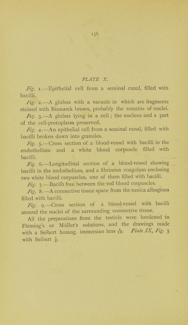 156 PLATE X. Fig. i.—Epithelial cell from a seminal canal, filled with bacilli. Fig. 2.—A globus with a vacuole in which are fragments stained with Bismarck brown, probably the remains of nuclei. Fi* 3.—a globus lying in a cell : the nucleus and a part of the cell-protoplasm preserved. Fig. 4.—An epithelial cell from a seminal canal, filled with bacilli broken down into granules. Fig. 5.—Cross section of a blood-vessel with bacilli in the endothelium and a white blood corpuscle filled with bacilli. Fig, 6.—Longitudinal section of a blood-vessel showing bacilli in the endothelium, and a fibrinous coagulum enclosing two white blood corpuscles, one of them filled with bacilli. Jug, 7.—Bacilli free between the red blood corpuscles. Fig, 8.—A connective tissue space from the tunica albuginea filled with bacilli. pig, 9.—Cross section of a blood-vessel with bacilli around the nuclei of the surrounding connective tissue. All the preparations from the testicle were hardened in Fleming's or Midler's solutions, and the drawings made with a Seibert homog. immersion lens A- Plate IX, Fig. 5 with Seibert