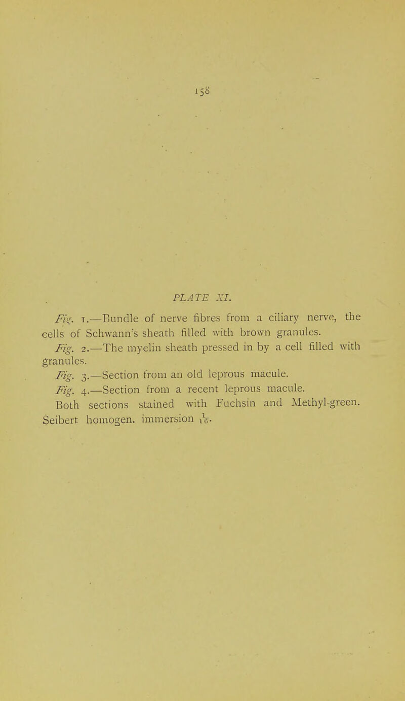 l$8 PLATE XI. Fi(r. t.—Bundle of nerve fibres from a ciliary nerve, the cells of Schwann's sheath filled with brown granules. Fig. 2.—The myelin sheath pressed in by a cell filled with granules. j?igt 3.—Section from an old leprous macule. j?ig_ 4.—Section from a recent leprous macule. Both sections stained with Fuchsin and Methyl-green. Seibert homogen. immersion tV-